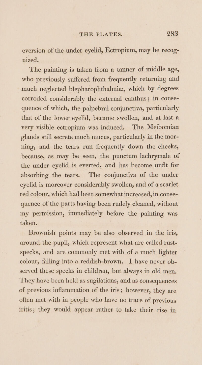 eversion of the under eyelid, Ectropium, may be recog- nized. The painting is taken from a tanner of middle age, who previously suffered from frequently returning and much neglected blepharophthalmize, which by degrees corroded considerably the external canthus; in conse- quence of which, the palpebral conjunctiva, particularly that of the lower eyelid, became swollen, and at last a very visible ectropium was induced. 'The Meibomian glands still secrete much mucus, particularly in the mor- ning, and the tears run frequently down the cheeks, because, as may be seen, the punctum lachrymale of the under eyelid is everted, and has become unfit for absorbing the tears. The conjunctiva of the under eyelid is moreover considerably swollen, and of a scarlet red colour, which had been somewhat increased, in conse- quence of the parts having been rudely cleaned, without my permission, immediately before the painting was taken. Brownish points may be also observed in the iris, around the pupil, which represent what are called rust- specks, and are commonly met with of a much lighter colour, falling into a reddish-brown. I have never ob- served these specks in children, but always in old men. They have been held as sugilations, and as consequences of previous inflammation of the iris; however, they are often met with in people who have no trace of previous iritis; they would appear rather to take their rise in