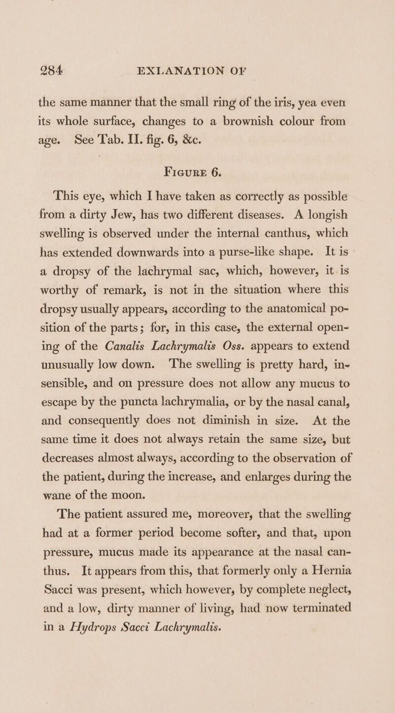 the same manner that the small ring of the iris, yea even its whole surface, changes to a brownish colour from age. See Tab. II. fig. 6, &c. Ficure 6. This eye, which I have taken as correctly as possible from a dirty Jew, has two different diseases. A longish swelling is observed under the internal canthus, which has extended downwards into a purse-like shape. It is a dropsy of the lachrymal sac, which, however, it. is worthy of remark, is not in the situation where this dropsy usually appears, according to the anatomical po- sition of the parts; for, in this case, the external open- ing of the Canalis Lachrymalis Oss. appears to extend unusually low down. ‘The swelling is pretty hard, in- sensible, and on pressure does not allow any mucus to escape by the puncta lachrymalia, or by the nasal canal, and consequently does not diminish in size. At the same time it does not always retain the same size, but decreases almost always, according to the observation of the patient, during the increase, and enlarges during the wane of the moon. The patient assured me, moreover, that the swelling had at a former period become softer, and that, upon pressure, mucus made its appearance at the nasal can- thus. It appears from this, that formerly only a Hernia Sacci was present, which however, by complete neglect, and a low, dirty manner of living, had now terminated in a Hydrops Sacct Lachrymalis.