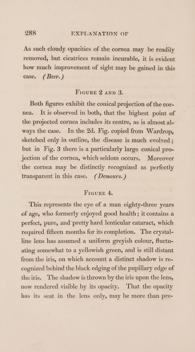 As such cloudy opacities of the cornea may be readily removed, but cicatrices remain incurable, it is evident how much improvement of sight may be gained in this case. ( Beer.) FIGureE 2 AND 3. Both figures exhibit the conical projection of the cor- nea. It is observed in both, that the highest point of the projected cornea includes its centre, as is almost al- ways the case. In the 2d. Fig. copied from Wardrop, sketched only in outline, the disease is much evolved ; but in Fig. 3 there is a particularly large conical pro- jection of the cornea, which seldom occurs. Moreover the cornea may be distinctly recognized as_ perfectly transparent in this case. (Demours. ) Figure 4. This represents the eye of a man eighty-three years of age, who formerly enjoyed good health; it contains a perfect, pure, and pretty hard lenticular cataract, which required fifteen months for its completion. The crystal- line lens has assumed a uniform greyish colour, fluctu- ating somewhat to a yellowish green, and is still distant from the iris, on which account a distinct shadow is re- cognized behind the black edging of the pupillary edge of theiris. The shadow is thrown by the iris upon the lens, now rendered visible by its opacity. That the opacity has its seat in the lens only, may be more than pre-