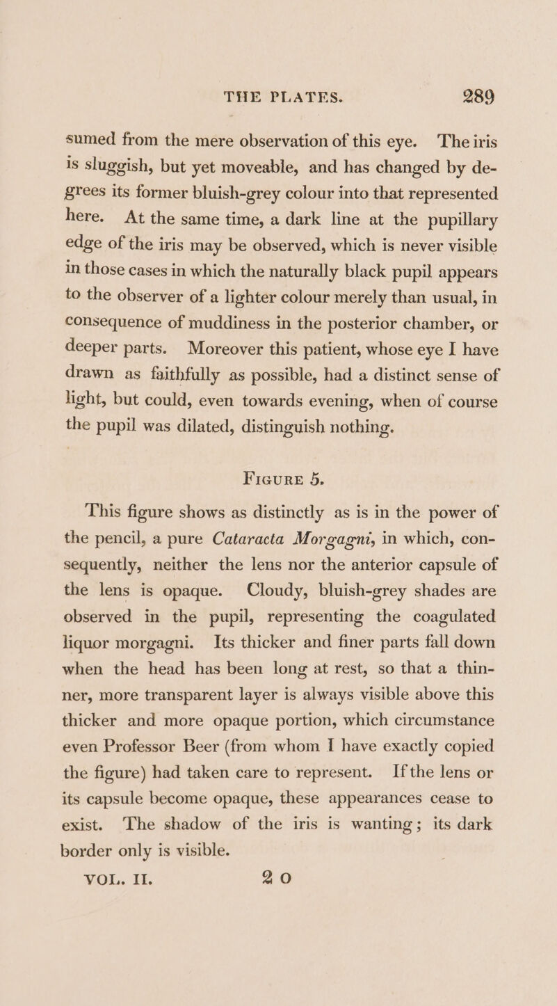 sumed from the mere observation of this eye. The iris is sluggish, but yet moveable, and has changed by de- grees its former bluish-grey colour into that represented here. At the same time, a dark line at the pupillary edge of the iris may be observed, which is never visible in those cases in which the naturally black pupil appears to the observer of a lighter colour merely than usual, in consequence of muddiness in the posterior chamber, or deeper parts. Moreover this patient, whose eye I have drawn as faithfully as possible, had a distinct sense of light, but could, even towards evening, when of course the pupil was dilated, distinguish nothing. Ficure 5. This figure shows as distinctly as is in the power of the pencil, a pure Cataracta Morgagni, in which, con- sequently, neither the lens nor the anterior capsule of the lens is opaque. Cloudy, bluish-grey shades are observed in the pupil, representing the coagulated liquor morgagni. Its thicker and finer parts fall down when the head has been long at rest, so that a thin- ner, more transparent layer is always visible above this thicker and more opaque portion, which circumstance even Professor Beer (from whom I have exactly copied the figure) had taken care to represent. Ifthe lens or its capsule become opaque, these appearances cease to exist. The shadow of the iris is wanting; its dark border only is visible. VOL. II. 2 O