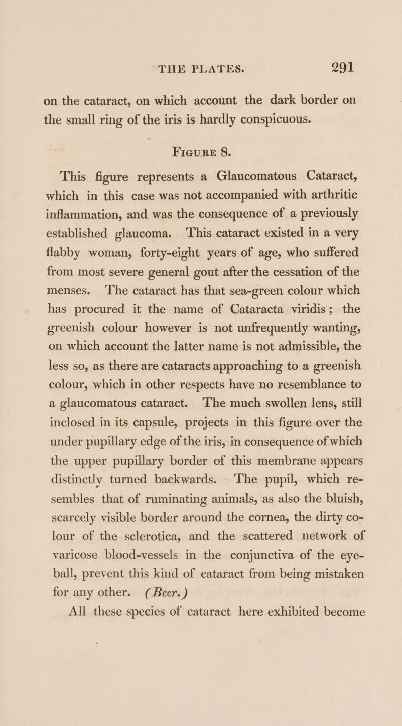 on the cataract, on which account the dark border on the small ring of the iris is hardly conspicuous. Figure 8. This figure represents a Glaucomatous Cataract, which in this case was not accompanied with arthritic inflammation, and was the consequence of a previously established glaucoma. ‘This cataract existed in a very flabby woman, forty-eight years of age, who suffered from most severe general gout after the cessation of the menses. The cataract has that sea-green colour which has procured it the name of Cataracta viridis; the greenish colour however is not unfrequently wanting, on which account the latter name is not admissible, the less so, as there are cataracts approaching to a greenish colour, which in other respects have no resemblance to a glaucomatous cataract. ‘I‘he much swollen lens, still inclosed in its capsule, projects in this figure over the under pupillary edge of the iris, in consequence of which the upper pupillary border of this membrane appears distinctly turned backwards. The pupil, which re- sembles that of ruminating animals, as also the bluish, scarcely visible border around the cornea, the dirty co- lour of the sclerotica, and the scattered network of varicose blood-vessels in the conjunctiva.of the eye- ball, prevent this kind of cataract from being mistaken for any other. (Beer. ) All these species of cataract here exhibited become
