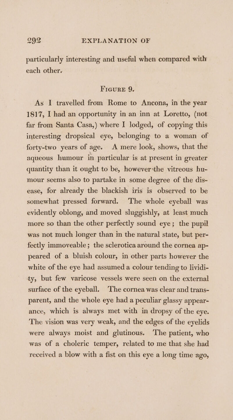 particularly interesting and useful when compared with each other. FIGurE 9. As I travelled from Rome to Ancona, in the year 1817, I had an opportunity in an inn at Loretto, (not far from Santa Casa,) where I lodged, of copying this interesting dropsical eye, belonging to a woman of forty-two years of age. A mere look, shows, that the aqueous humour in particular is at present in greater quantity than it ought to be, however-the vitreous hu- mour seems also to partake in some degree of the dis- ease, for already the blackish iris is observed to be somewhat pressed forward. The whole eyeball was evidently oblong, and moved sluggishly, at least much more so than the other perfectly sound eye; the pupil was not much longer than in the natural state, but per- fectly immoveable; the sclerotica around the cornea ap- peared of a bluish colour, in other parts however the white of the eye had assumed a colour tending to lividi- ty, but few varicose vessels were seen on the external surface of the eyeball. The cornea was clear and trans- parent, and the whole eye had a peculiar glassy appear- ance, which is always met with in dropsy of the eye. The vision was very weak, and the edges of the eyelids were always moist and glutinous. ‘The patient, who was of a choleric temper, related to me that she had received a blow with a fist on this eye a long time ago,