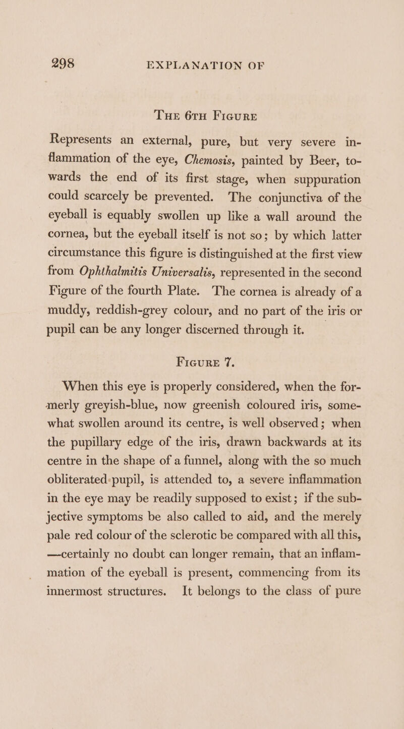 Tue 6TH Figure Represents an external, pure, but very severe in- flammation of the eye, Chemosis, painted by Beer, to- wards the end of its first stage, when suppuration could scarcely be prevented. The conjunctiva of the eyeball is equably swollen up like a wall around the cornea, but the eyeball itself is not so; by which latter circumstance this figure is distinguished at the first view from Ophthalmitis Universalis, represented in the second Figure of the fourth Plate. The cornea is already of a muddy, reddish-grey colour, and no part of the iris or pupil can be any longer discerned through it. | Ficure 7. When this eye is properly considered, when the for- merly greyish-blue, now greenish coloured iris, some- what swollen around its centre, is well observed; when the pupillary edge of the iris, drawn backwards at its centre in the shape of a funnel, along with the so much obliterated:pupil, is attended to, a severe inflammation in the eye may be readily supposed to exist; if the sub- jective symptoms be also called to aid, and the merely pale red colour of the sclerotic be compared with all this, —certainly no doubt can longer remain, that an inflam- mation of the eyeball is present, commencing from its innermost structures. It belongs to the class of pure