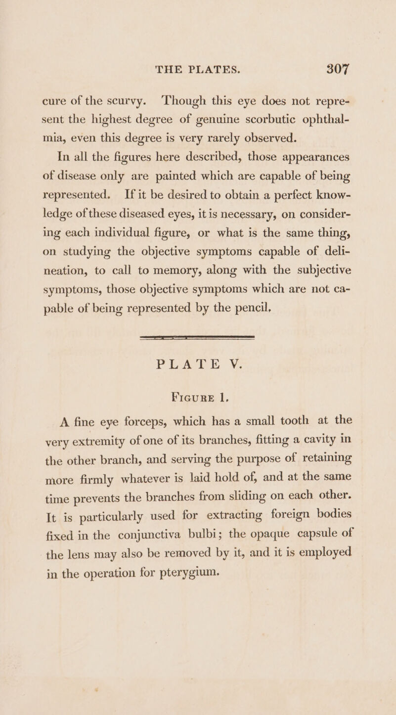 cure of the scurvy. Though this eye does not repre- sent the highest degree of genuine scorbutic ophthal- mia, even this degree is very rarely observed. In all the figures here described, those appearances of disease only are painted which are capable of being represented. If it be desired to obtain a perfect know- ledge of these diseased eyes, it is necessary, on consider- ing each individual figure, or what is the same thing, on studying the objective symptoms capable of deli- neation, to call to memory, along with the subjective symptoms, those objective symptoms which are not ca- pable of being represented by the pencil, PEA? EY; FIGURE Il, A fine eye forceps, which has a small tooth at the very extremity of one of its branches, fitting a cavity in the other branch, and serving the purpose of retaining more firmly whatever is laid hold of, and at the same time prevents the branches from sliding on each other. It is particularly used for extracting foreign bodies fixed in the conjunctiva bulbi; the opaque capsule of the lens may also be removed by it, and it is employed in the operation for pterygium.