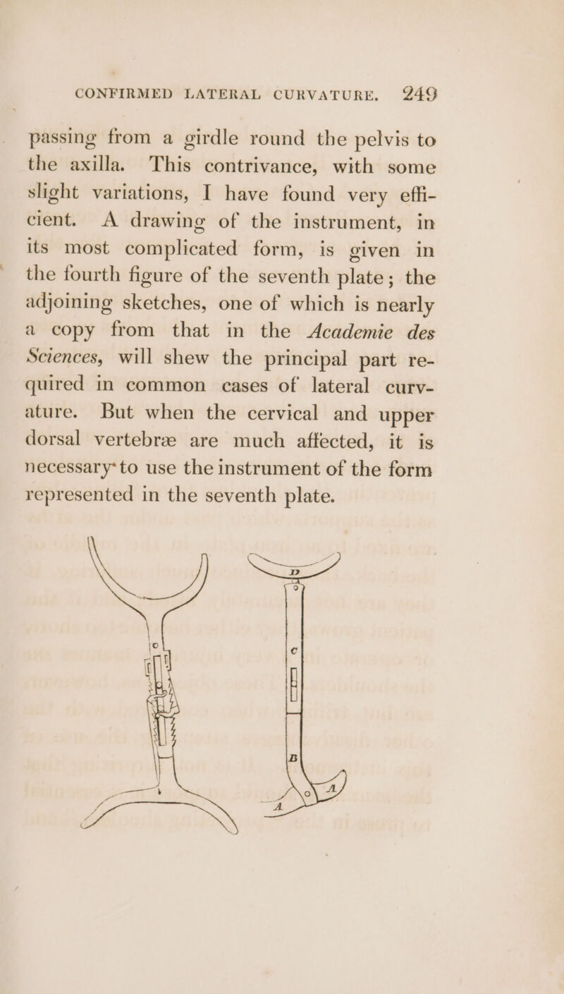 passing from a girdle round the pelvis to the axilla. This contrivance, with some slight variations, I have found very effi- cient. A drawing of the instrument, in its most complicated form, is given in the fourth figure of the seventh plate; the adjoining sketches, one of which is nearly a copy from that in the Academie des Sciences, will shew the principal part re- quired in common cases of lateral curv- ature. But when the cervical and upper dorsal vertebree are much affected, it is necessary*to use the instrument of the form represented in the seventh plate.
