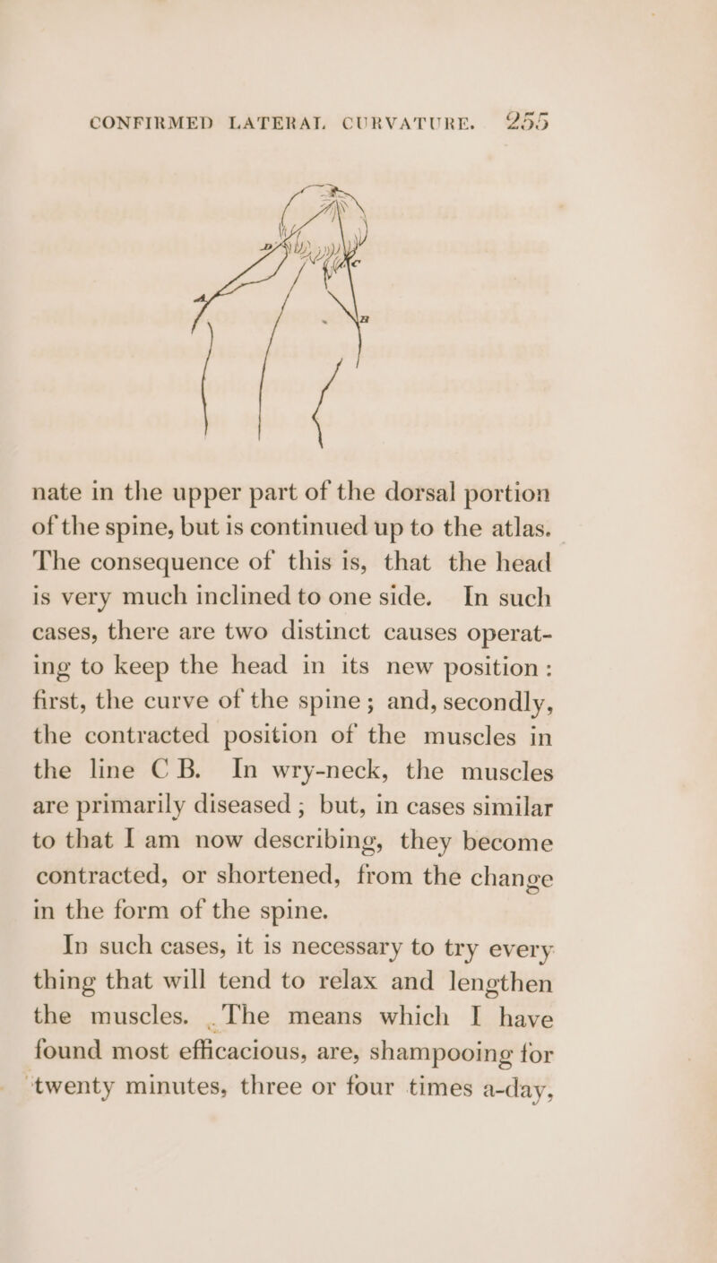 nate in the upper part of the dorsal portion of the spine, but is continued up to the atlas. The consequence of this is, that the head is very much inclined to one side. In such cases, there are two distinct causes operat- ing to keep the head in its new position: first, the curve of the spine; and, secondly, the contracted position of the muscles in the line CB. In wry-neck, the muscles are primarily diseased ; but, in cases similar to that I am now describing, they become contracted, or shortened, from the change in the form of the spine. In such cases, it is necessary to try every thing that will tend to relax and lengthen the muscles. .The means which I have found most efficacious, are, shampooing tor ‘twenty minutes, three or four times a-day,