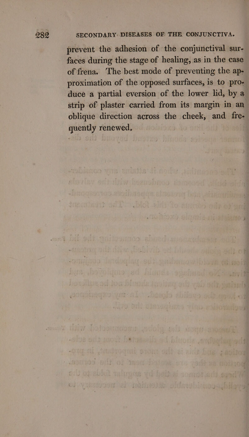 289 SECONDARY: DISEASES OF THE CONJUNCTIVA. prevent the adhesion of the conjunctival sur- faces during the stage of healing, as in the case of frena. The best mode of preventing the ap- proximation of the opposed surfaces, is to pro- duce a partial eversion of the lower lid, by a strip of plaster carried from its margin in an oblique direction across the cheek, and fre- quently renewed, |