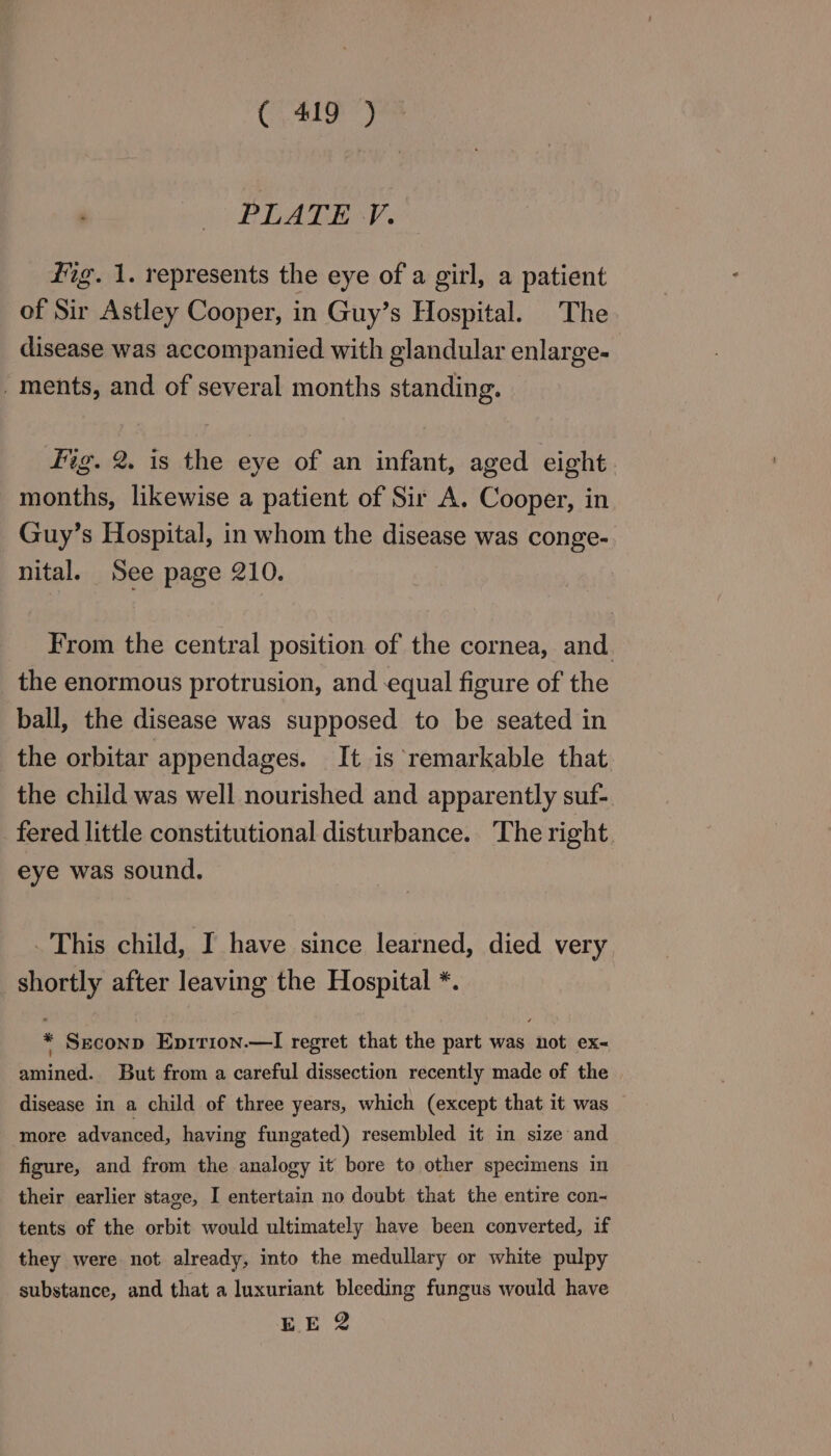 Ci ale yee PLATE V. fig. 1. represents the eye of a girl, a patient of Sir Astley Cooper, in Guy’s Hospital. The disease was accompanied with glandular enlarge- . ments, and of several months standing. fig. 2. is the eye of an infant, aged eight months, likewise a patient of Sir A. Cooper, in Guy’s Hospital, in whom the disease was conge-. nital. See page 210. From the central position of the cornea, and _ the enormous protrusion, and equal figure of the ball, the disease was supposed to be seated in the orbitar appendages. It is remarkable that the child was well nourished and apparently suf- fered little constitutional disturbance. The right. eye was sound. This child, I have since learned, died very shortly after leaving the Hospital *. * Seconp Eprrion.—I regret that the part was not ex- amined. But from a careful dissection recently made of the disease in a child of three years, which (except that it was more advanced, having fungated) resembled it in size and figure, and from the analogy it bore to other specimens in their earlier stage, I entertain no doubt that the entire con- tents of the orbit would ultimately have been converted, if they were not already, into the medullary or white pulpy substance, and that a luxuriant bleeding fungus would have EE 2