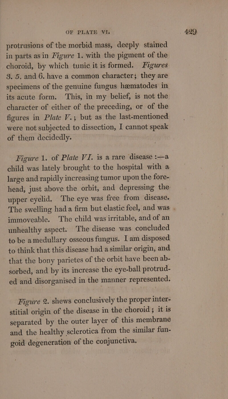 protrusions of the morbid mass, deeply stained in parts asin Figure 1. with the pigment of the choroid, by which tunic it is formed. J%gures 3. 5. and 6. have a common character; they are specimens of the genuine fungus heematodes in its acute form. ‘This, in my belief, is not the character of either of the preceding, or of the figures in Plate V.; but as the last-mentioned were not subjected to dissection, I cannot speak of them decidedly. Figure 1. of Plate VI. is a rare disease :—a child was lately brought to the hospital with a large and rapidly increasing tumor upon the fore- head, just above the orbit, and depressing the upper eyelid. The eye was free from disease. immoveable. The child was irritable, and of an unhealthy aspect. The disease was concluded to be amedullary osseous fungus. I am disposed to think that this disease had a similar origin, and. that the bony parietes of the orbit have been ab- sorbed, and by its increase the eye-ball protrud- ed and disorganised in the manner represented. Figure 2. shews conclusively the proper inter- stitial origin of the disease in the choroid ; it is separated by the outer layer of this membrane and the healthy sclerotica from the similar fun- goid degeneration of the conjunctiva.