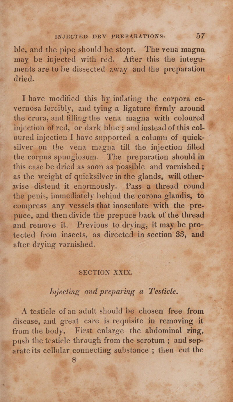 ble, and the pipe should be stopt. The vena magna may be injected with red. After this the integu- dried. Rr sine { have modiied this by inifstne he corpora ca- the corpus spungiosum. The preparation should in the penis, immediately behind the corona glandis, ‘to ~ after drying varnished. SECTION XXIX. Injecting and preparing a Testicle. A testicle of an adult should be chosen free from disease, and great care is requisite in removing it from the body. First enlarge the abdominal ring, push the testicle through from the scrotum ; and sep- &gt; , arate its cellular connecting ‘substance ; ; then cut the “8 i ok fyeey * to ay i io Pe NRE Wan We parr Mahia ok aries Eitiec aR oa pa SU