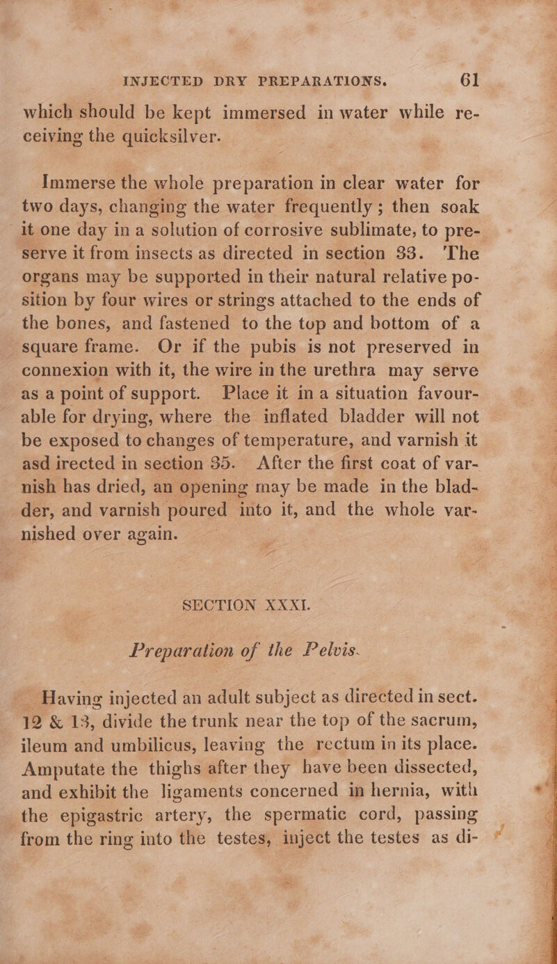 which should be kept immersed in water while re- ceiving the quicksilver. Immerse the whole preparation in clear water for two days, changing the water frequently ; ; then soak serve it from insects as directed in section 33. ‘The organs may be supported in their natural relative po- sition by four wires or strings attached to the ends of the bones, and fastened to the tup and bottom of a square frame. Or if the pubis is not preserved in connexion with it, the wire in the urethra may serve as a point of support. Place it ina situation favour- able for drying, where the inflated bladder will not be exposed to changes of temperature, and varnish it asd irected in section 35. After the first coat of var- nish has dried, an opening may be made in the blad- der, and varnish poured into it, and the whole var- nished over again. SECTION XXXT. Preparation of the Pelvis. ‘Having injected an adult subject as directed in sect. 1 &amp; 13, divide the trunk near the top of the sacrum, ileum and umbilicus, leaving the rectum in its place. Amputate the thighs after they have been dissected, and exhibit the ligaments concerned in hernia, with the epigastric artery, the spermatic cord, passing from the ring into the testes, inject the testes as di- Wer) iat a teeasaet a he