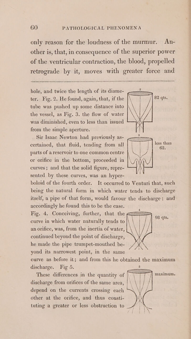 only reason for the loudness of the murmur. An- other is, that, in consequence of the superior power of the ventricular contraction, the blood, propelled retrograde by it, moves with greater force and hole, and twice the length of its diame- ter. Fig. 2. He found, again, that, if the tube was pushed up some distance into the vessel, as Fig. 3. the flow of water was diminished, even to less than issued from the simple aperture. Sir Isaac Newton had previously as- less than certained, that fluid, tending from all a parts of a reservoir to one common centre or orifice in the bottom, proceeded in curves; and that the solid figure, repre- sented by these curves, was an hyper- boloid of the fourth order. It occurred to Venturi that, such being the natural form in which water tends to discharge itself, a pipe of that form, would favour the discharge: and accordingly he found this to be the case. Fig. 4. Conceiving, further, that the == curve in which water naturally tends to |i | an orifice, was, from the inertia of water, continued beyond the point of discharge, he made the pipe trumpet-mouthed be- yond its narrowest point, in the same curve as before it; and from this he obtained the maximum discharge. Fig 5. These differences in the quantity of ou Cf &lt;j) maximum. discharge from orifices of the same area, : depend on the currents crossing each other at the orifice, and thus consti- tuting a greater or less obstruction to