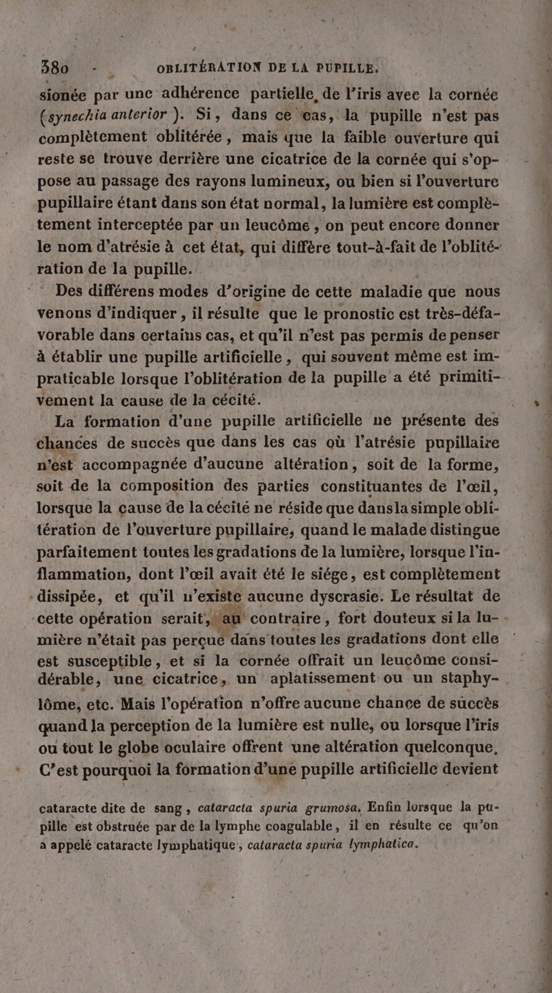 LA AE, OBLITERATION DE LA PUPILLE. JON par une adhérence partielle, de l'iris avee la cornée (synechia anterior ). Si, dans ce cas, la pupille n'est pas complètement oblitérée, mais que la faible ouverture qui reste se trouve derrière une cicatrice de la cornée qui s’op- pose au passage des rayons lumineux, ou bien si l’ouverture pupillaire étant dans son état normal, la lumière est complè- tement interceptée par un leucôme , on peut encore donner ration de la pupille. Des différens modes d’origine de cette maladie que nous venons d'indiquer , il résulte que le pronostic est très-défa- vorable dans certains cas, et qu’il n’est pas permis de penser à établir une pupille artificielle , qui souvent même est im- praticable lorsque l’oblitération de la pupille a été primiti- vement la cause de la cécité. chances de succès que dans les cas où l’atrésie pupillaire n° rest accompagnée d’aucune altération, soit de la forme, soit de la composition des parties constituantes de l’œil, lorsque la cause de la cécité ne réside que dansla simple obli- tération de l'ouverture pupillaire, quand le malade distingue parfaitement toutes les gradations de la lumière, lorsque l'in- flammation, dont l’œil avait été le siége, est complètement -dissipée, et qu’il u’existe aucune dyscrasie. Le résultat de mière n’était pas perçue dans toutes les gradations dont elle est susceptible, et si la cornée offrait un leucôme consi- dérable, une cicatrice, un aplatissement ou un staphy- löme, etc. Mais l'opération n'offre aucune chance de succès quand Ja perception de la lumière est nulle, ou lorsque l'iris ou tout le globe oculaire offrent une altération quelconque, C’est pourquoi la formation d’une pupille artificielle devient cataracte dite de sang, cataracta spuria grumosa, Enfin lorsque la pu- à appelé cataracte lymphatique, cataracta spuria Iymphatica. PR ère EL im un à