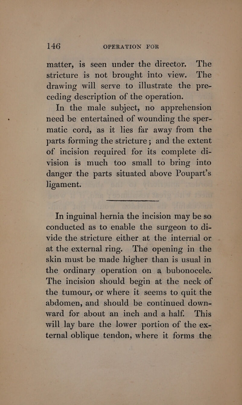 matter, is seen under the director. The stricture is not brought into view. The drawing will serve to illustrate the pre- ceding description of the operation. In the male subject, no apprehension need be entertained of wounding the sper- matic cord, as it lies far away from the parts forming the stricture; and the extent of incision required for its complete di- vision is much too small to bring into danger the parts situated above Poupart’s ligament. In inguinal hernia the incision may be so conducted as to enable the surgeon to di- vide the stricture either at the internal or at the external ring. ‘The opening in the skin must be made higher than is usual in the ordinary operation on a bubonocele. The incision should begin at the neck of the tumour, or where it seems to quit the abdomen, and should be continued down- ward for about an inch and a half. This will lay bare the lower portion of the ex- ternal oblique tendon, where it forms the