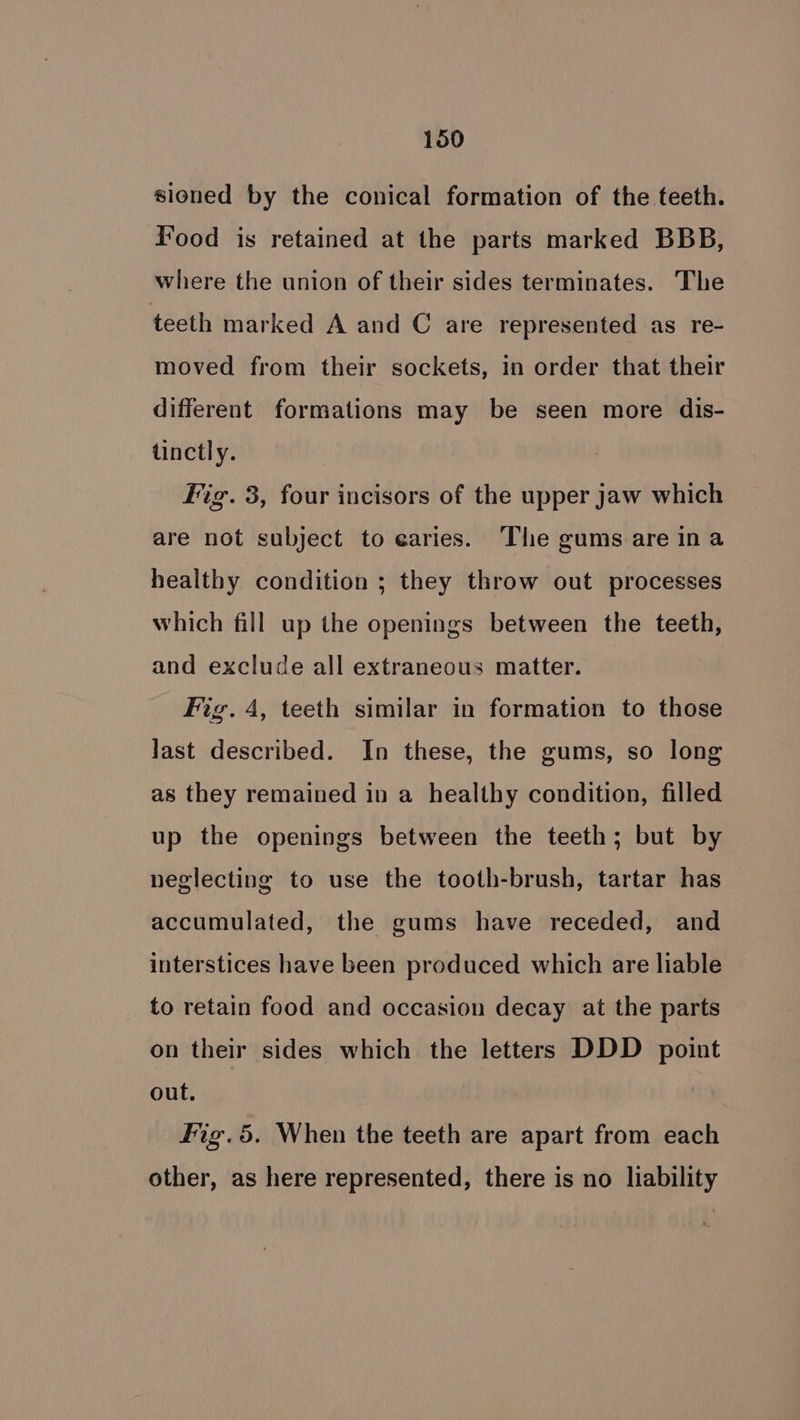 sioned by the conical formation of the teeth. Food is retained at the parts marked BBB, where the union of their sides terminates. The teeth marked A and C are represented as re- moved from their sockets, in order that their different formations may be seen more dis- tinctly. Fig. 3, four incisors of the upper jaw which are not subject to earies. The gums are ina healthy condition ; they throw out processes which fill up the openings between the teeth, and exclude all extraneous matter. Fig. 4, teeth similar in formation to those last described. In these, the gums, so long as they remained in a healthy condition, filled up the openings between the teeth; but by neglecting to use the tooth-brush, tartar has accumulated, the gums have receded, and interstices have been produced which are liable _ to retain food and occasion decay at the parts on their sides which the letters DDD point out. Fig.5. When the teeth are apart from each other, as here represented, there is no liability