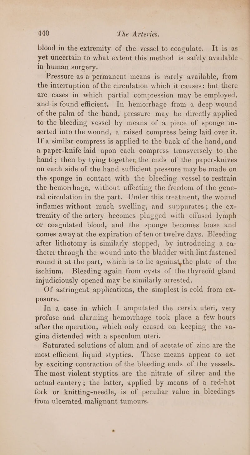 blood in the extremity of the vessel to coagulate. It is as yet uncertain to what extent this method is safely available in human surgery. Pressure as a permanent means is rarely available, from the interruption of the circulation which it causes: but there are cases in which partial compression may be employed, and is found efficient. In hemorrhage from a deep wound of the palm of the hand, pressure may be directly applied to the bleeding vessel by means of a piece of sponge in- serted into the wound, a raised compress being laid over it. If a similar compress is applied to the back of the hand, and a paper-knife laid upon each compress transversely to the hand; then by tying together, the ends of the paper-knives on each side of the hand sufficient pressure may be made on the sponge in contact with the bleeding vessel to restrain the hemorrhage, without affecting the freedom of the gene- ral circulation in the part. Under this treatment, the wound inflames without much swelling, and suppurates; the ex- tremity of the artery becomes plugged with effused lymph or coagulated blood, and the sponge becomes loose and comes away at the expiration of ten or twelve days. Bleeding after lithotomy is similarly stopped, by introducing a ca- theter through the wound into the bladder with lint fastened round it at the part, which is to lie against,the plate of the ischium. Bleeding again from cysts of the thyreoid gland injudiciously opened may be similarly arrested. Of astringent applications, the simplest is cold from ex- posure. In a case in which I amputated the cervix uteri, very profuse and alarming hemorrhage took place a few hours after the operation, which only ceased on keeping the va- gina distended with a speculum uteri. Saturated solutions of alum and of acetate of zinc are the most efficient liquid styptics. These means appear to act by exciting contraction of the bleeding ends of the vessels. The most violent styptics are the nitrate of silver and the actual cautery; the latter, applied by means of a red-hot fork or knitting-needle, is of peculiar value in bleedings from ulcerated malignant tumours.