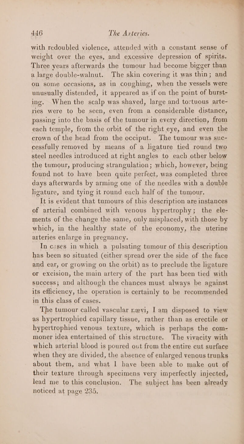 with redoubled violence, attended with a constant sense of weicht over the eyes, and excessive depression of spirits. Three years afterwards the tumour had become bigger than a large double-walnut. The skin covering it was thin; and on some occasions, as in coughing, when the vessels were unusually distended, it appeared as if on the point of burst- ing. When the scalp was shaved, large and tortuous arte- ries were to be seen, even from a considerable distance, passing into the basis of the tumour in every direction, from each temple, from the orbit of the right eye, and even the crown of the head from the occiput. The tumour was suc- cessfully removed by means of a ligature tied round two steel needles introduced at right angles to each other below the tumour, producing strangulation; which, however, being found not to have been quite perfect, was completed three days afterwards by arming one of the needles with a double heature, and tying it round each half of the tumour. It is evident that tumours of this description are instances of arterial combined with venous hypertrophy; the ele- ments of the change the same, only misplaced, with those by which, in the healthy state of the economy, the uterine arteries enlarge in pregnancy. In cases in which a pulsating tumour of this description has been so situated (either spread over the side of the face and ear, or growing on the orbit) as to preclude the ligature or excision, the main artery of the part has been tied with success; and although the chances must always be against its efficiency, the operation is certainly to be recommended in this class of cases. The tumour called vascular nevi, I am disposed to view as hypertrophied capillary tissue, rather than as erectile or hypertrophied venous textnre, which is perhaps the com- moner idea entertained of this structure. The vivacity with which arterial blood is poured out from the entire cut surface when they are divided, the absence of enlarged venous trunks about them, and what I have been able to make out of their texture through specimens very imperfectly injected, lead me to this conclusion. The subject has been already noticed at page 235.