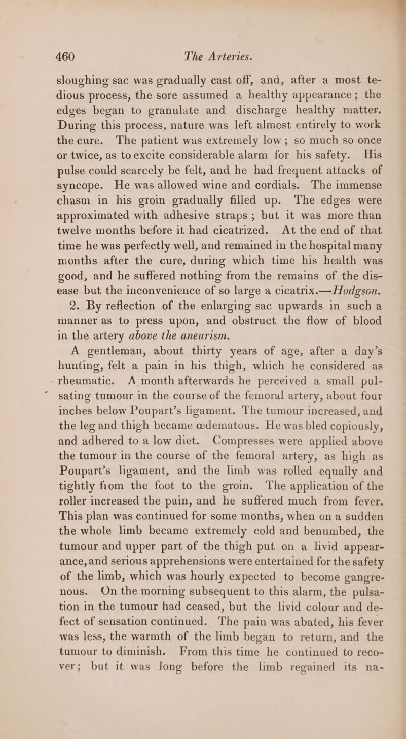 sloughing sac was gradually cast off, and, after a most te- dious process, the sore assumed a healthy appearance; the edees began to granulate and discharge healthy matter. During this process, nature was left almost entirely to work the cure. The patient was extremely low; so much so once or twice, as to excite considerable alarm for his safety. His pulse could scarcely be felt, and he had frequent attacks of syncope. He was allowed wine and cordials. The immense chasm in his groin gradually filled up. The edges were approximated with adhesive straps; but it was more than twelve months before it had cicatrized. At the end of that time he was perfectly well, and remained in the hospital many months after the cure, during which time his health was good, and he suffered nothing from the remains of the dis- ease but the inconvenience of so large a cicatrix.— Hodgson. 2. By reflection of the enlarging sac upwards in sucha manner as to press upon, and obstruct the flow of blood in the artery above the aneurism. A gentleman, about thirty years of age, after a day’s hunting, felt a pain in his thigh, which he considered as rheumatic. A month afterwards he perceived a small pul- sating tumour in the course of the femoral artery, about four inches below Poupart’s ligament. The tumour increased, and the leg and thigh became edematous. He was bled copiously, and adhered to a low diet. Compresses were applied above the tumour in the course of the femoral artery, as high as Poupart’s ligament, and the limb was rolled equally and tightly from the foot to the groin. The application of the roller increased the pain, and he suffered much from fever. This plan was continued for some months, when on a sudden the whole limb became extremely cold and benumbed, the tumour and upper part of the thigh put on a livid appear- ance, and serious apprehensions were entertained for the safety of the limb, which was hourly expected to become gangre- nous. On the morning subsequent to this alarm, the pulsa- tion in the tumour had ceased, but the livid colour and de- fect of sensation continued. The pain was abated, his fever was less, the warmth of the limb began to return, and the tumour to diminish. From this time he continued to reco- ver; but it was long before the limb regained its na-