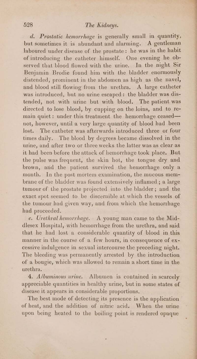 d. Prostatic hemorrhage is generally small in quantity, but sometimes it is abundant and alarming. A gentleman laboured under disease of the prostate: he was in the habit of introducing the catheter himself. One evening he ob- served that blood flowed with the urine. In the night Sir Benjamin Brodie found him with the bladder enormously distended, prominent in the abdomen as high as the navel, and blood still flowing from the urethra. A large catheter was introduced, but no urine escaped: the bladder was dis- tended, not with urine but with blood. The patient was directed to lose blood, by cupping on the loins, and to re- main quiet: under this treatment the hemorrhage ceased— not, however, until a very large quantity of blood had been lost. The catheter was afterwards introduced three or four times daily. The blood by degrees became dissolved in the urine, and after two or three weeks the latter was as clear as it had been before the attack of hemorrhage took place. But the pulse was frequent, the skin hot, the tongue dry and brown, and the patient survived the hemorrhage only a month. In the post mortem examination, the mucous mem- brane of the bladder was found extensively inflamed ; a large tumour of the prostate projected into the bladder; and the exact spot seemed to be discernible at which the vessels of the tumour had given way, and from which the hemorrhage had proceeded. e. Urethral hemorrhage. A young man came to the Mid- dlesex Hospital, with hemorrhage from the urethra, and said that he had lost a considerable quantity of blood in this manner in the course of a few hours, in consequence of ex- cessive indulgence in sexual intercourse the preceding night. The bleeding was permanently arrested by the introduction of a bougie, which was allowed to remain a short time in the urethra. 4. Albuminous urine. Albumen is contained in scarcely appreciable quantities in healthy urine, but in some states of disease it appears in considerable proportions. of heat, and the addition of nitric acid. When the urine upon being heated to the boiling point is rendered opaque A ett el