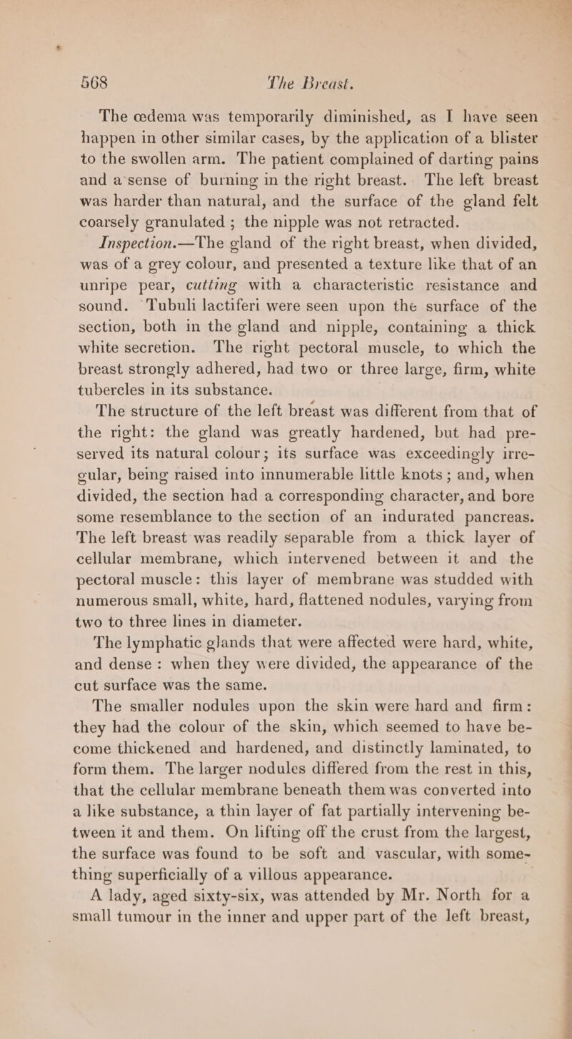 The cedema was temporarily diminished, as I have seen happen in other similar cases, by the application of a blister to the swollen arm. The patient complained of darting pains and a sense of burning in the right breast. The left breast was harder than natural, and the surface of the gland felt coarsely granulated ; the nipple was not retracted. Inspection.—The gland of the right breast, when divided, was of a grey colour, and presented a texture like that of an unripe pear, cutting with a characteristic resistance and sound. Tubuli lactifert were seen upon the surface of the section, both in the gland and nipple, containing a thick white secretion. The right pectoral muscle, to which the tubercles in its substance. The structure of the left breast was different from that of the right: the gland was greatly hardened, but had pre- served its natural colour; its surface was exceedingly irre- gular, being raised into innumerable little knots ; and, when divided, the section had a corresponding character, and bore some resemblance to the section of an indurated pancreas. The left breast was readily separable from a thick layer of cellular membrane, which intervened between it and the pectoral muscle: this layer of membrane was studded with numerous small, white, hard, flattened nodules, varying from two to three lines in diameter. The lymphatic glands that were affected were hard, white, and dense: when they were divided, the appearance of the cut surface was the same. The smaller nodules upon the skin were hard and firm: they had the colour of the skin, which seemed to have be- come thickened and hardened, and distinctly laminated, to form them. The larger nodules differed from the rest in this, that the cellular membrane beneath them was converted into a like substance, a thin layer of fat partially intervening be- tween it and them. On lifting off the crust from the largest, the surface was found to be soft and vascular, with some~ thing superficially of a villous appearance. A lady, aged sixty-six, was attended by Mr. North for a small tumour in the inner and upper part of the left breast,