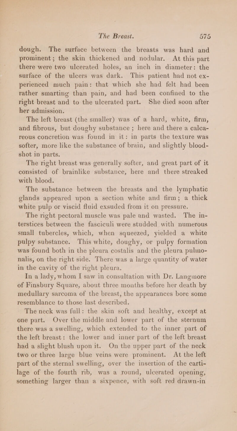 dough. The surface between the breasts was hard and prominent; the skin thickened and nodular. At this part there were two ulcerated holes, an inch in diameter: the surface of the ulcers was dark. This patient had not ex- perienced much pain: that which she had felt had been rather smarting than pain, and had been confined to the right breast and to the ulcerated part. She died soon after her admission. The left breast (the smaller) was of a hard, white, firm, and fibrous, but doughy substance ; here and there a calca- reous concretion was found in it: in parts the texture was softer, more like the substance of brain, and slightly blood- shot in parts. The right breast was generally softer, and great part of it consisted of brainlike substance, here and there streaked with blood. The substance between the breasts and the lymphatic glands appeared upon a section white and firm; a thick white pulp or viscid fluid exsuded from it on pressure. The right pectoral muscle was pale and wasted. The in- terstices between the fasciculi were studded with numerous small tubercles, which, when squeezed, yielded a white pulpy substance. This white, doughy, or pulpy formation was found both in the pleura costalis and the pleura pulimo- nalis, on the right side. There was a large quantity of water in the cavity of the right pleura. In a lady, whom [| saw in consultation with Dr. Langmore of Finsbury Square, about three mouths before her death by medullary sarcoma of the breast, the appearances bore some resemblance to those last described. The neck was full: the skin soft and healthy, except at one part. Over the middle and lower part of the sternum there was a swelling, which extended to the inner part of the left breast: the lower and inner part of the left breast had a slight blush upon it. On the upper part of the neck two or three large blue veins were prominent. At the left part of the sternal swelling, over the insertion of the carti- lage of the fourth rib, was a round, ulcerated opening, something larger than a sixpence, with soft red drawn-in