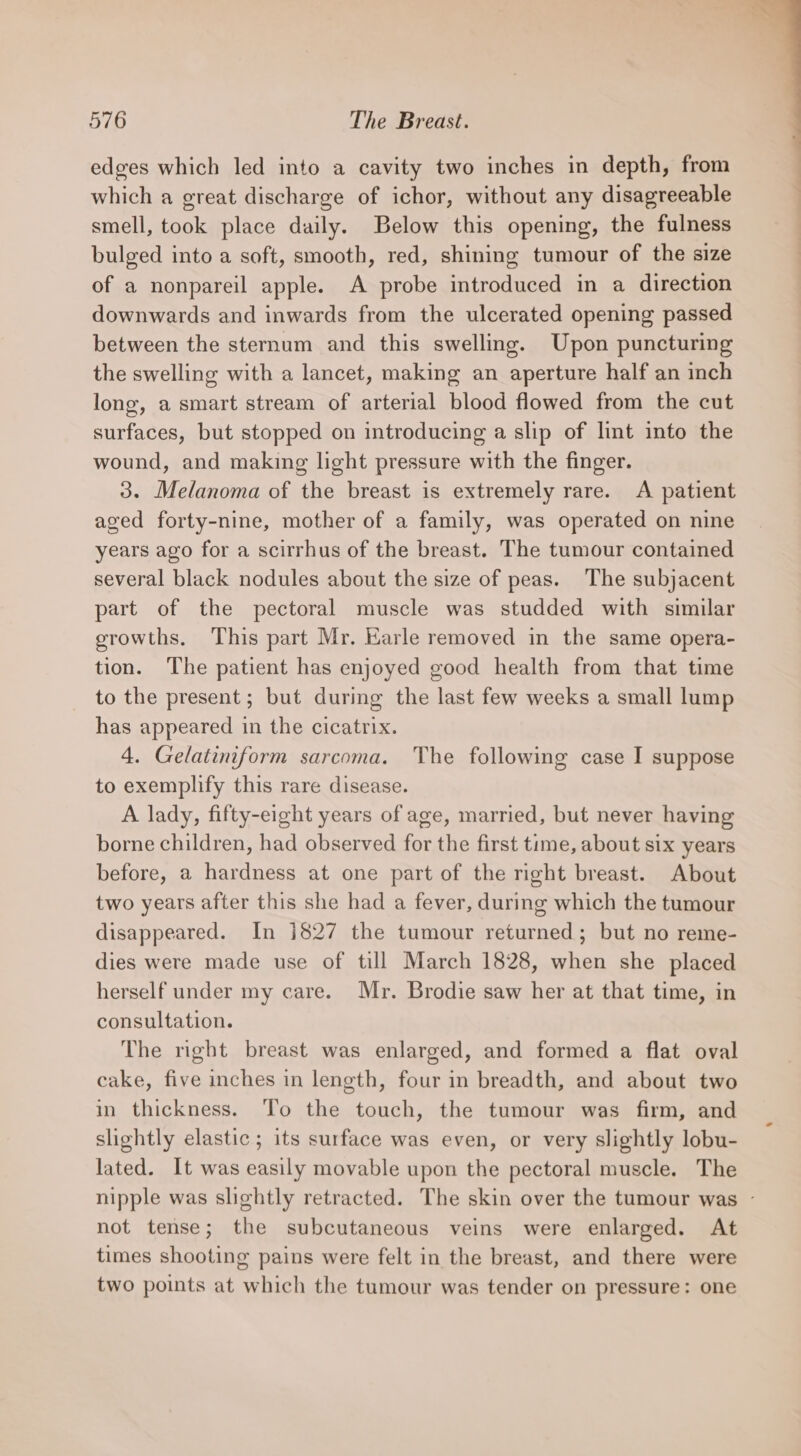 edges which led into a cavity two inches in depth, from which a great discharge of ichor, without any disagreeable smell, took place daily. Below this opening, the fulness bulged into a soft, smooth, red, shining tumour of the size of a nonpareil apple. A probe introduced in a direction downwards and inwards from the ulcerated opening passed between the sternum and this swelling. Upon puncturing the swelling with a lancet, making an aperture half an inch long, a smart stream of arterial blood flowed from the cut surfaces, but stopped on introducing a slip of lint into the wound, and making light pressure with the finger. 3. Melanoma of the breast is extremely rare. A patient aged forty-nine, mother of a family, was operated on nine years ago for a scirrhus of the breast. The tumour contained several black nodules about the size of peas. The subjacent part of the pectoral muscle was studded with similar growths. This part Mr. Earle removed in the same opera- tion. The patient has enjoyed good health from that time to the present ; but during the last few weeks a small lump has appeared in the cicatrix. 4. Gelatiniform sarcoma. The following case I suppose to exemplify this rare disease. A lady, fifty-eight years of age, married, but never having borne children, had observed for the first time, about six years before, a hardness at one part of the right breast. About two years after this she had a fever, during which the tumour disappeared. In 1827 the tumour returned; but no reme- dies were made use of till March 1828, when she placed herself under my care. Mr. Brodie saw her at that time, in consultation. The right breast was enlarged, and formed a flat oval cake, five inches in length, four in breadth, and about two in thickness. To the touch, the tumour was firm, and slightly elastic; its surface was even, or very slightly lobu- lated. It was easily movable upon the pectoral muscle. The nipple was slightly retracted. The skin over the tumour was - not tense; the subcutaneous veins were enlarged. At times shooting pains were felt in the breast, and there were two points at which the tumour was tender on pressure: one