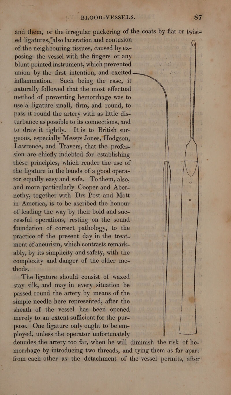 and them, or the irregular puckering of the coats by flat or twist~ ed ligatures, “also laceration and contusion of the neighbouring tissues, caused by ex- posing the vessel with the fingers or any blunt pointed instrument, which prevented union by the first intention, and excited inflammation. Such being the case, it naturally followed that the most effectual method of preventing hemorrhage was to use a ligature small, firm, and round, to pass it round the artery with as little dis- turbance as possible to its connections, and to draw it tightly. It is to British sur- geons, especially Messrs Jones, Hodgson, Lawrence, and Travers, that the profes- sion are chiefly indebted for establishing these principles, which render the use of the ligature in the hands of a good opera- tor equally easy and safe. To them, also, and more particularly Cooper and Aber- nethy, together with Drs Post and Mott in America, is to be ascribed the honour of leading the way by their bold and suc- cessful operations, resting on the sound foundation of correct pathology, to the practice of the present day in the treat- ment of aneurism, which contrasts remark- ably, by its simplicity and safety, with the complexity and danger of the older me- thods. The ligature should consist of waxed stay silk, and may in every. situation be passed round the artery by means of the simple needle here represented, after the sheath of the vessel has been opened merely to an extent sufficient for the pur- pose. One ligature only ought to be em- ployed, unless the operator unfortunately denudes the artery too far, when he will diminish the risk of he- morrhage by introducing two threads, and tying them as far apart from each other as the detachment of the vessel permits, after