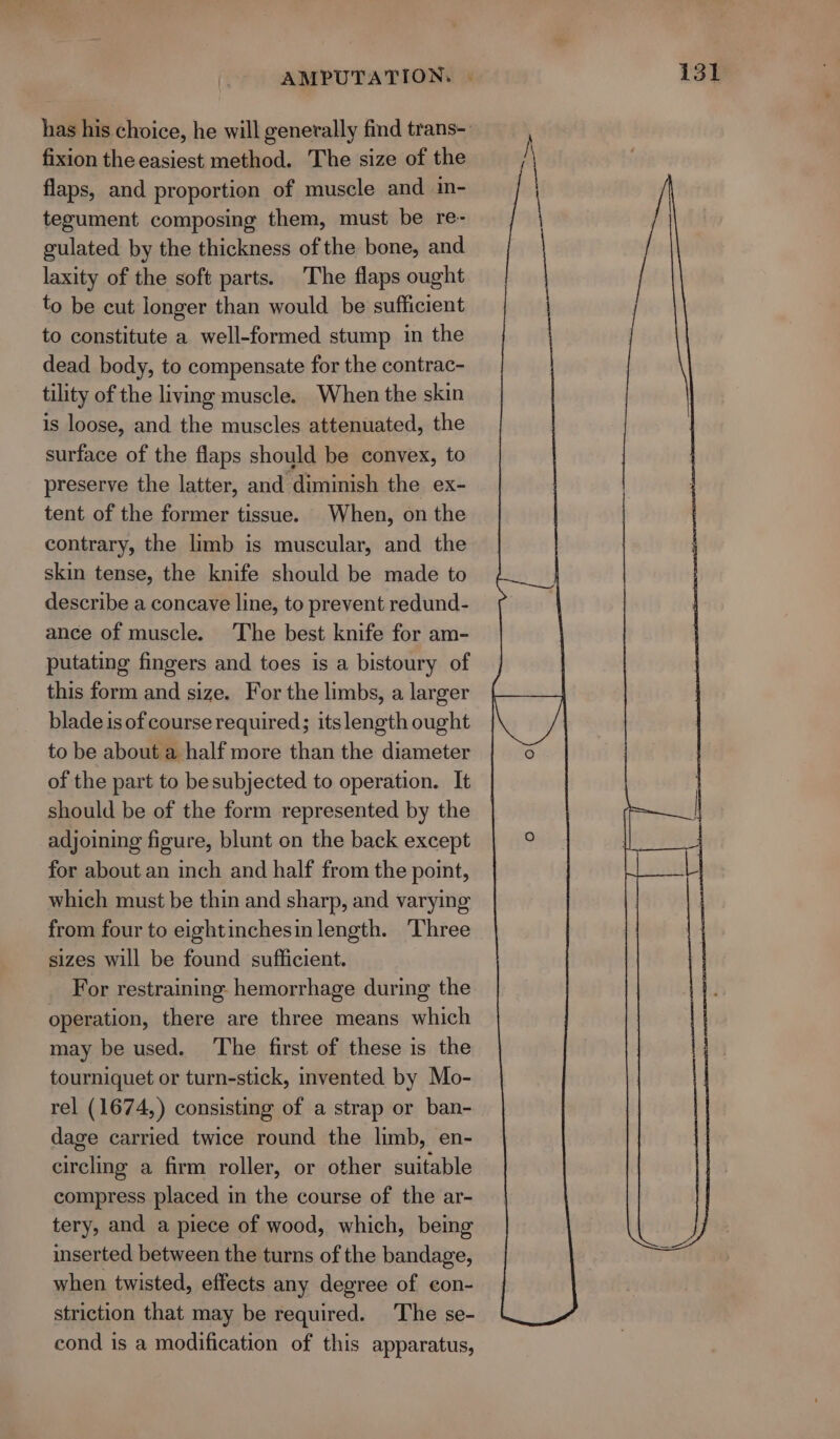 fixion the easiest method. The size of the flaps, and proportion of muscle and in- tegument composing them, must be re- gulated by the thickness of the bone, and laxity of the soft parts. The flaps ought to be cut longer than would be sufficient to constitute a well-formed stump in the dead body, to compensate for the contrac- tility of the living muscle. When the skin is loose, and the muscles attenuated, the surface of the flaps should be convex, to preserve the latter, and diminish the ex- tent of the former tissue. When, on the contrary, the limb is muscular, and the skin tense, the knife should be made to describe a concave line, to prevent redund- ance of muscle. The best knife for am- putating fingers and toes is a bistoury of this form and size. For the limbs, a larger blade is of course required; itslength ought to be about a half more than the diameter of the part to besubjected to operation. It should be of the form represented by the adjoining figure, blunt on the back except for about an inch and half from the point, which must be thin and sharp, and varying from four to eightinchesin length. Three sizes will be found sufficient. For restraining hemorrhage during the operation, there are three means which may be used. The first of these is the tourniquet or turn-stick, invented by Mo- rel (1674,) consisting of a strap or ban- dage carried twice round the limb, en- circling a firm roller, or other suitable compress placed in the course of the ar- tery, and a piece of wood, which, being inserted between the turns of the bandage, when twisted, effects any degree of con- striction that may be required. The se- cond is a modification of this apparatus,