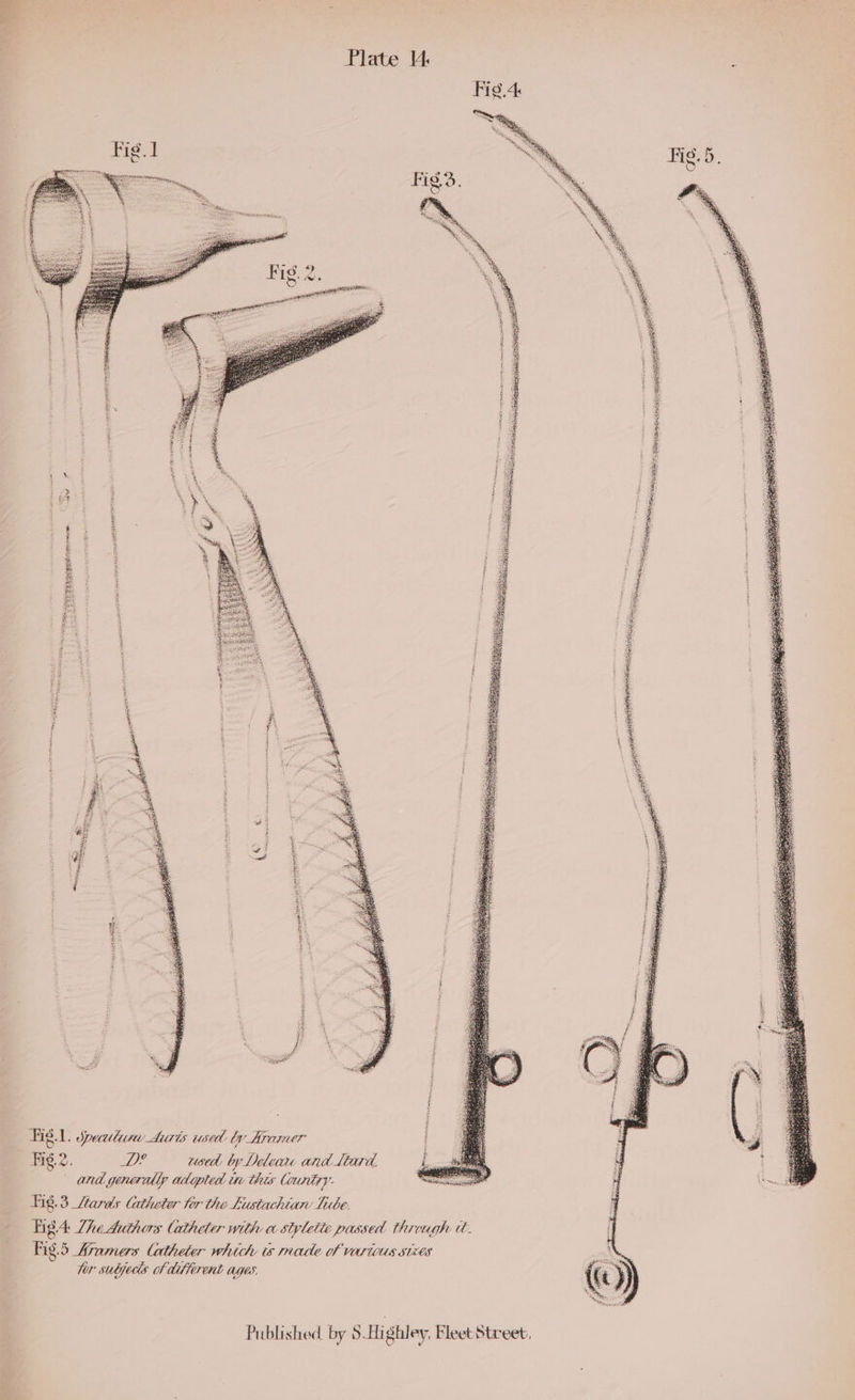 ec i APTS at ee eee iy erelnan ee) cas nenera Ct aetna ih CoRR RAPA MILT Sree coin Hig 1. sputum Auris used by Araner Fig.2. Wig used by Delear and lard and generally adopted in this Counizy: Lig.3 _Lards Catheter tor the Eustachian Tube. liga She Authas lathea with w styletie passed through a. Fig. 5 framers Catheter whith ts made of Various stxes for subjeds of different ages: Published by S-Highley, Fleet Street. mts i wae iS aaa ; ai ay Sas eh Tite eed ee Say