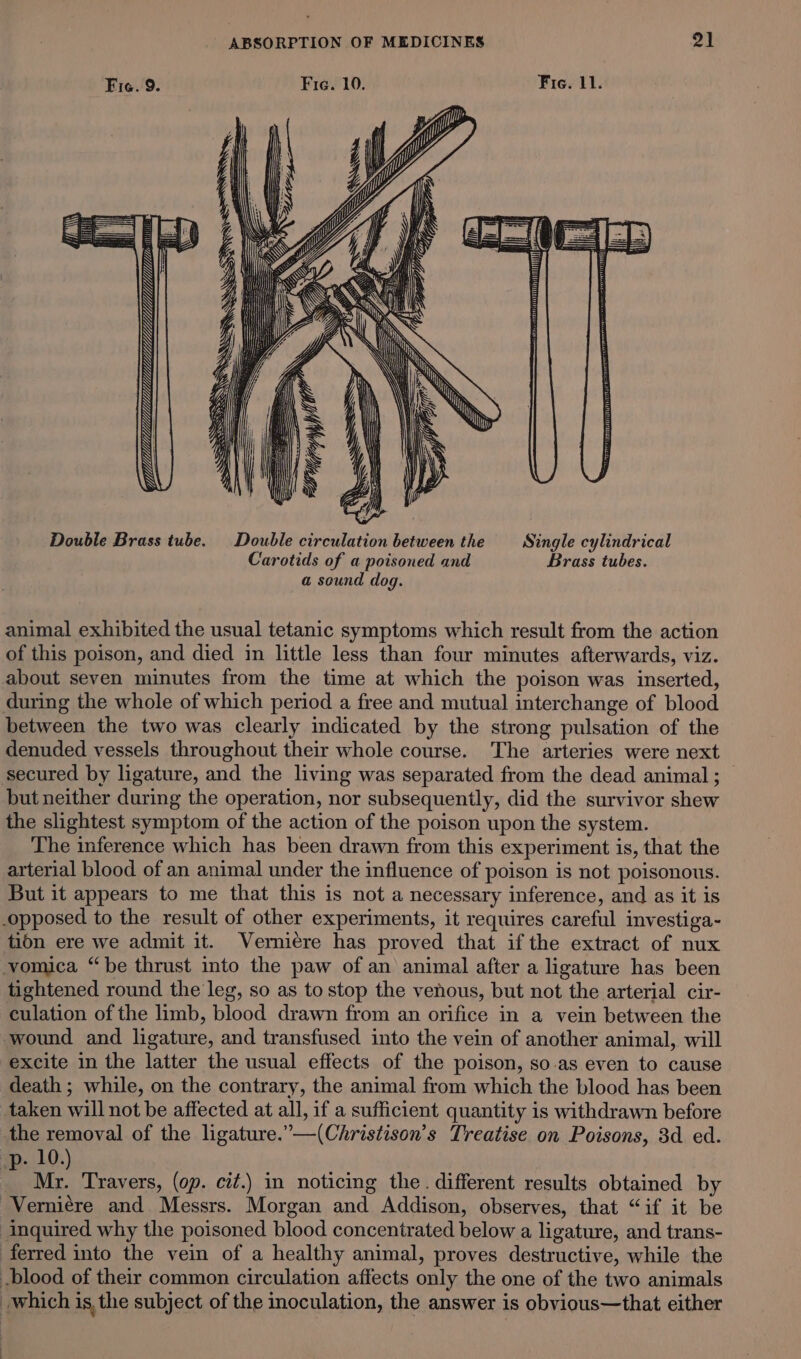 Fig. 9. Fie. 10. Fie. 11. ‘a Ir ST ap YIM Double Brass tube. Double circulation between the Single cylindrical Carotids of a poisoned and Brass tubes. a sound dog. animal exhibited the usual tetanic symptoms which result from the action of this poison, and died in little less than four minutes afterwards, viz. about seven minutes from the time at which the poison was inserted, during the whole of which period a free and mutual interchange of blood between the two was clearly indicated by the strong pulsation of the denuded vessels throughout their whole course. The arteries were next secured by ligature, and the living was separated from the dead animal ; but neither during the operation, nor subsequently, did the survivor shew the slightest symptom of the action of the poison upon the system. The inference which has been drawn from this experiment is, that the arterial blood of an animal under the influence of poison is not poisonous. But it appears to me that this is not a necessary inference, and as it is opposed to the result of other experiments, it requires careful investiga- tibn ere we admit it. Verniere has proved that if the extract of nux -vomica “be thrust into the paw of an animal after a ligature has been tightened round the leg, so as to stop the venous, but not the arterial cir- culation of the limb, blood drawn from an orifice in a vein between the wound and ligature, and transfused into the vein of another animal, will excite in the latter the usual effects of the poison, so.as even to cause death ; while, on the contrary, the animal from which the blood has been taken will not be affected at all, if a sufficient quantity is withdrawn before the removal of the ligature.’—(Christison’s Treatise on Poisons, 3d ed. . 10.) ‘ Mr. Travers, (op. cit.) in noticing the. different results obtained by Verniére and Messrs. Morgan and Addison, observes, that “if it be inquired why the poisoned blood concentrated below a ligature, and trans- ferred into the vein of a healthy animal, proves destructive, while the blood of their common circulation affects only the one of the two animals which is, the subject of the inoculation, the answer is obvious—that either