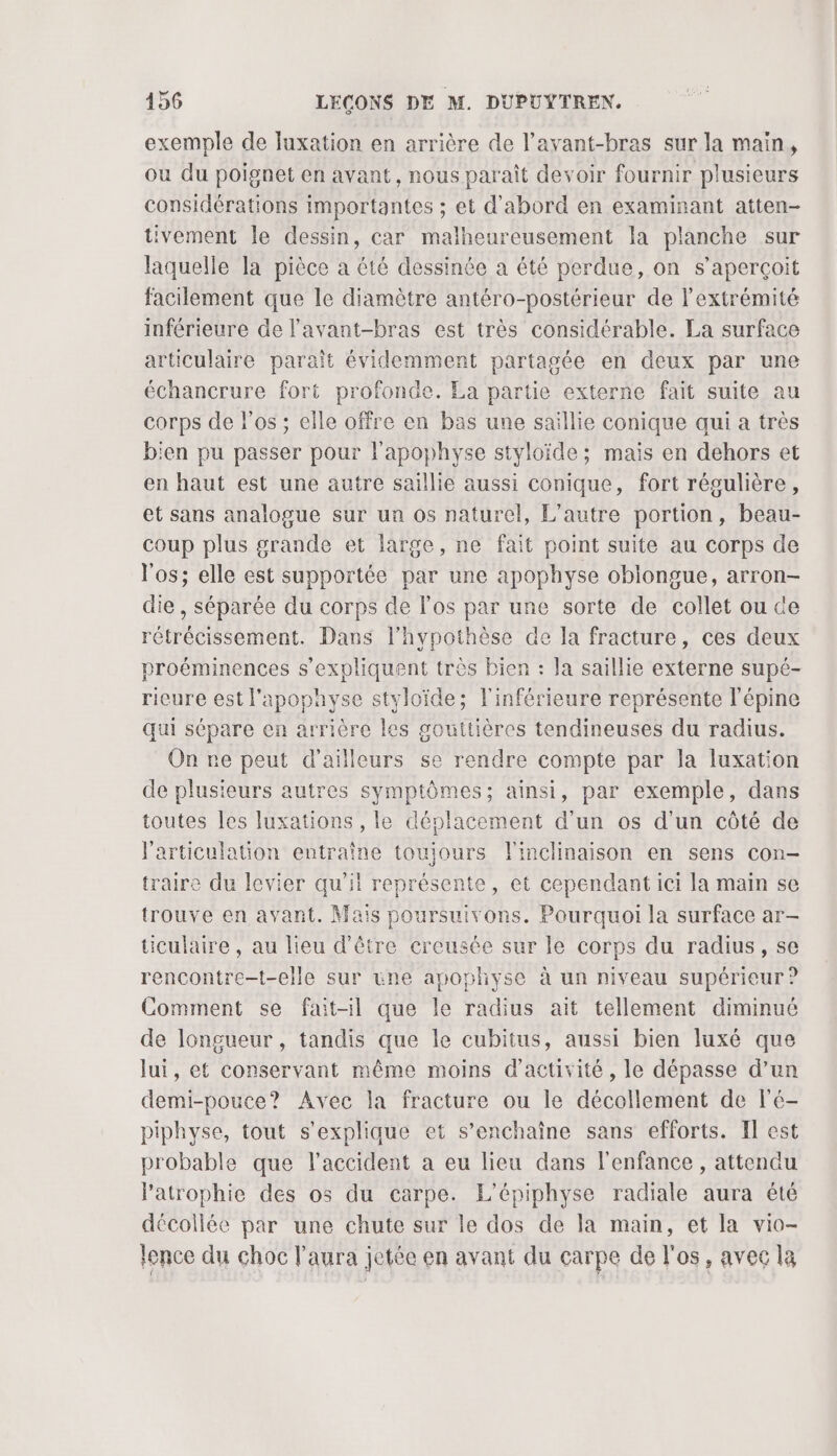 exemple de luxation en arrière de l’ayant-bras sur la main, ou du poignet en avant, nous paraît devoir fournir plusieurs considérations importantes ; et d'abord en examinant atten- ivement le dessin, car malheureusement la planche sur laquelle la pièce a été dessinée a été perdue, on s'aperçoit facilement que le diamètre antéro-postérieur de l'extrémité inférieure de l'avant-bras est très considérable. La surface articulaire parait évidemment partagée en deux par une échancrure fort profonde. La partie externe fait suite au corps de l'os ; elle offre en bas une saillie conique qui a très bien pu passer pour l’apophyse styloïde ; mais en dehors et en haut est une autre saillie aussi conique, fort régulière, et sans analogue sur ua os naturel, L'autre portion, beau- coup plus grande et large, ne fait point suite au corps de l'os; elle est supportée par une apophyse oblongue, arron- die , séparée du corps de l’os par une sorte de collet ou de rétrécissement. Dans l'hypothèse de la fracture, ces deux proéminences s'expliquent très bien : Ja saillie externe supé- ricure est l'apophyse styloïde; l'inférieure représente l'épine qui sépare en arrière les gouttières tendineuses du radius. On re peut d’ailleurs se rendre compte par la luxation de plusieurs autres symptômes; ainsi, par exemple, dans toutes les luxations , le déplacement d’un os d'un côté de l'articulation entraîne toujours l'inclinaison en sens con- traire du levier qu’il représente, et cependant ici la main se trouve en avant. Mais poursuivons. Pourquoi la surface ar- ticulaire , au lieu d'être creusée sur le corps du radius, se rencontre-t-elle sur une apophyse à un niveau supérieur ? Comment se fait-il que le radius ait tellement diminué de longueur, tandis que le cubitus, aussi bien luxé que lui, et conservant même moins d'activité , le dépasse d’un demi-pouce? Avec la fracture ou le décollement de l'é- piphyse, tout s'explique et s’enchaîne sans efforts. Il est probable que l'accident a eu lieu dans l'enfance , attendu l'atrophie des os du carpe. L'épiphyse radiale aura été décollée par une chute sur le dos de la main, et la vio- lence du choc l'aura jetée en avant du carpe de l'os, avec la