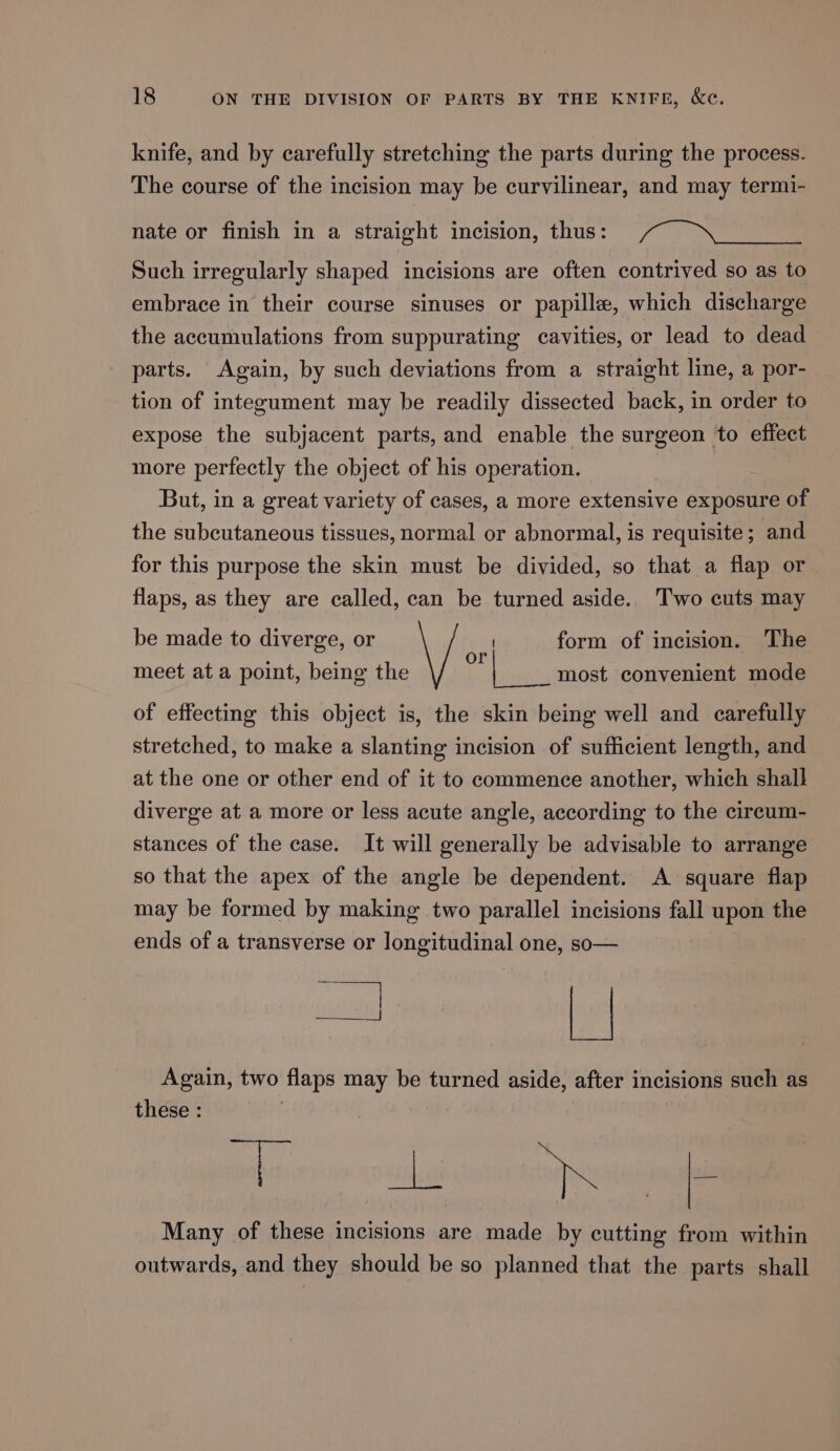 knife, and by carefully stretching the parts during the process. The course of the incision may be curvilinear, and may termi- nate or finish in a straight incision, thus: Such irregularly shaped incisions are often contrived so as to embrace in their course sinuses or papillae, which discharge the accumulations from suppurating cavities, or lead to dead parts. Again, by such deviations from a straight line, a por- tion of integument may be readily dissected back, in order to expose the subjacent parts, and enable the surgeon to effect more perfectly the object of his operation. But, in a great variety of cases, a more extensive exposure of the subcutaneous tissues, normal or abnormal, is requisite; and for this purpose the skin must be divided, so that a flap or flaps, as they are called, can be turned aside. Two cuts may be made to diverge, or \/ form of incision. The 0 meet at a point, being the most convenient mode of effecting this object is, the skin being well and carefully stretched, to make a slanting incision of sufficient length, and at the one or other end of it to commence another, which shall diverge at a more or less acute angle, according to the cireum- stances of the case. It will generally be advisable to arrange so that the apex of the angle be dependent. A square flap may be formed by making two parallel incisions fall upon the ends of a transverse or longitudinal one, so— te - Again, two flaps may be turned aside, after incisions such as oe Many of these incisions are made by cutting from within outwards, and they should be so planned that the parts shall