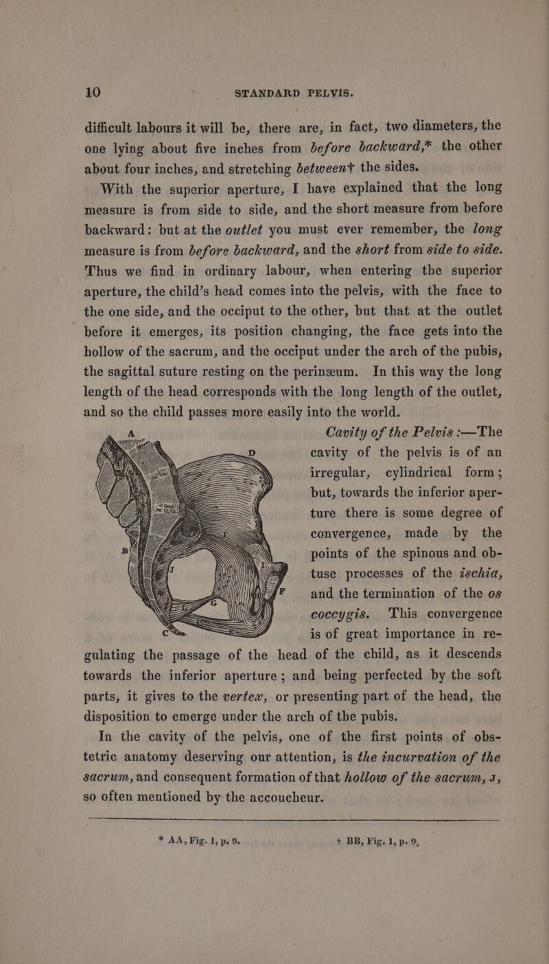difficult labours it will be, there are, in fact, two diameters, the one lying about five inches from before backward,* the other about four inches, and stretching between the sides. With the superior aperture, I have explained that the long measure is from side to side, and the short measure from before backward: but at the outlet you must ever remember, the long measure is from before backward, and the short from side to side. Thus we find in ordinary labour, when entering the superior aperture, the child’s head comes into the pelvis, with the face to the one side, and the occiput to the other, but that at the outlet before it emerges, its position changing, the face gets into the hollow of the sacrum, and the occiput under the arch of the pubis, the sagittal suture resting on the perineum. In this way the long length of the head corresponds with the long length of the outlet, and so the child passes more easily into the world. P us Cavity of the Pelvis :—The Me . ie UG \ ‘ Nd, cavity of the pelvis is of an 4) irregular, cylindrical form; but, towards the inferior aper- ture there is some degree of convergence, made by the points of the spinous and ob- tuse processes of the ischza, and the termination of the os coccygis. 'This convergence : is of great importance in re- gulating the passage of the head of the child, as it descends towards the inferior aperture; and being perfected by the soft parts, it gives to the vertex, or presenting part of the head, the disposition to emerge under the arch of the pubis. In the cavity of the pelvis, one of the first points of obs- tetric anatomy deserving our attention, is the incurvation of the sacrum, and consequent formation of that hollow of the sacrum, J, so often mentioned by the accoucheur. * AA, Fig. 1, p. 9. + BB, Fig. 1, p. 9,