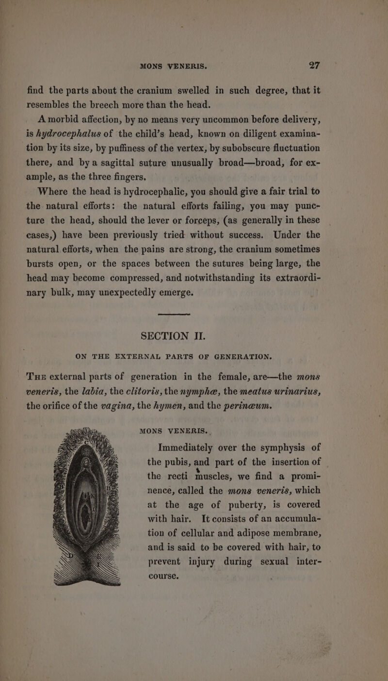 MONS VENERIS. ry find the parts about the cranium swelled in such degree, that it resembles the breech more than the head. A morbid affection, by no means very uncommon before delivery, is hydrocephalus of the child’s head, known on diligent examina- tion by its size, by puffiness of the vertex, by subobscure fluctuation there, and bya sagittal suture unusually broad—broad, for ex- ample, as the three fingers, Where the head is hydrocephalic, you should give a fair trial to the natural efforts: the natural efforts failing, you may punc- ture the head, should the lever or forceps, (as generally in these cases,) have been previously tried without success. Under the natural efforts, when the pains are strong, the cranium sometimes bursts open, or the spaces between the sutures being large, the head may become compressed, and notwithstanding its extraordi- nary bulk, may unexpectedly emerge. SECTION II. ON THE EXTERNAL PARTS OF GENERATION, Tue external parts of generation in the female, are—the mons veneris, the labia, the clitoris, the nymphe, the meatus urinarius, the orifice of the vagina, the hymen, and the perineum. MONS VENERIS.. Immediately over the symphysis of the pubis, and part of the insertion of _ the recti muscles, we find a promi- nence, called the mons veneris, which at the age of puberty, is covered with hair. It consists of an accumula- tion of cellular and adipose membrane, and is said to be covered with hair, to prevent injury during sexual inter- course.