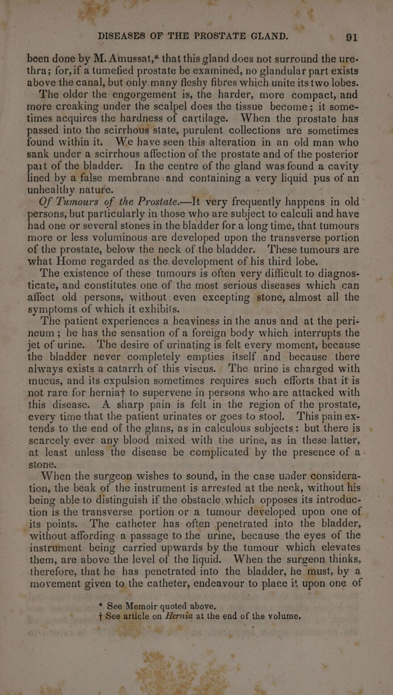 been done by M. Amussat,* that this gland does not surround the ure- thra; for,if a tumefied prostate be examined, no glandular part exists above the canal, but only many fleshy fibres which unite its two lobes. The older the engorgement is, the harder, more compact, and more creaking under the scalpel does the tissue become; it some- times acquires the hardness of cartilage. When the prostate has passed into the scirrhous state, purulent. collections are sometimes found within it. We have seen this alteration in an old man who sank under a scirrhous affection of the prostate and of the posterior pait of the bladder. In the centre of the gland was found a cavity lined by a false membrane and containing a yew liquid pus of an unhealthy nature. Of Tumours of the Prostate-—It- very frequently. happens in old persons, but particularly in those who are subject to calculi and have had one or several stones in the bladder for a long time, that tumours more or less voluminous are developed upon the transverse portion of the prostate, below the neck of the bladder. These tumours are what Home regarded as the. development of his third lobe. The existence of these tumours is often very difficult to diagnos- ticate, and constitutes one of the most serious diseases which can affect old persons, without even excepting stone, almost all the symptoms of which it exhibits. The patient experiences a heaviness in the anus and. at the peri- neum ; he has the sensation of a foreign body which interrupts the jet of urine. The desire of urinating is felt every moment, because the bladder never completely empties itself and because there always exists a catarrh of this viscus. The urine is charged with mucus, and.its expulsion sometimes requires such efforts that it is ‘not rare for herniat to supervene in persons who are attacked with this disease. A sharp pain is felt in the region of the prostate, every time that the patient urinates or goes to stool. This pain ex- tends to the end of the glans, as in calculous subjects: but there is scarcely ever any blood mixed with the urine, as in these latter, at least unless the disease be complicated by the presence of a. stone. | When the surgeon wishes to sound, in the case uader considera- tion, the beak of the instrument is arrested at the neck, without his being able to distinguish if the obstacle which opposes its introduc- tion is the transverse portion or a tumour developed upon one of _its points. The catheter has often penetrated into the bladder, “without affording. a passage to the urine, because the eyes of the instrument being carried upwards by the tumour which elevates them, are above the level of the liquid. When the surgeon thinks, therefore, that he has penetrated into the bladder, he must, by a movement pike uhe catheters endeapaurs to place it upon one of t * See Memoir Pies «hi fer article on Hernia at the end of He volume. Rae À 5 # SS ‘ » ay wae &gt; . &gt;. à 4 : “4 * ‘ “et ta,” L 4, vie f à +, LR 4 ve OA, 13