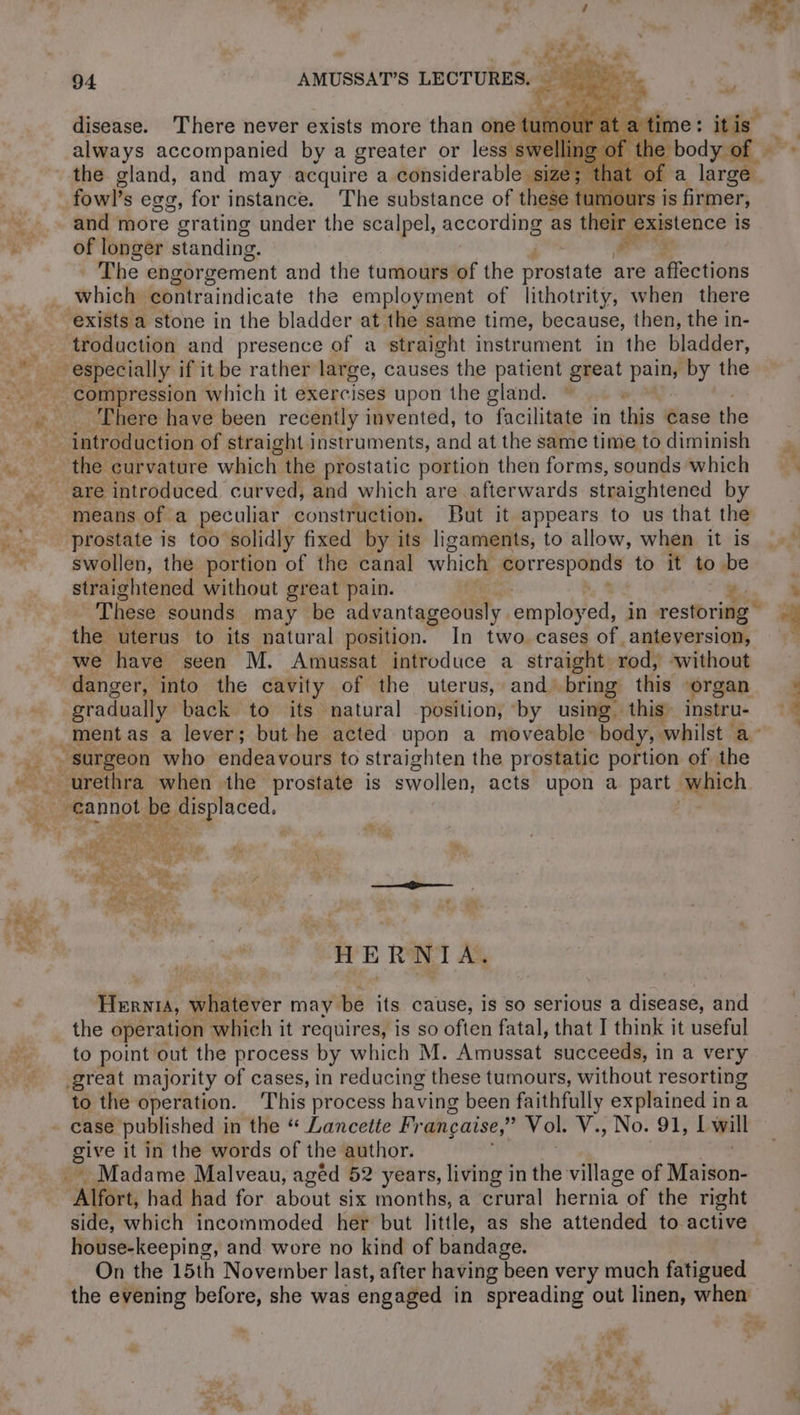 94 AMUSSAT’S LECTURES. disease. There never exists more than one tatiols always accompanied by a greater or less swel the gland, and may acquire a considerable size; tl of a i: fowls egg, for instance. The substance of these : tumours is firmer, and more grating under the scalpel, according as their existence is of longer standing. | # * The engorgement and the tumours of the prostate are affections exists a stone in the bladder at the same time, because, then, the in- troduction and presence of a straight instrument in the bladder, compression which it exercises upon the gland. There have been recently invented, to facilitate in this case the the curvature which the prostatic portion then forms, sounds which means of a peculiar construction. But it appears to us that the prostate is too solidly fixed by its ligaments, to allow, when it is swollen, the portion of the canal which prepa to it to be straightened without great pain. | 4. &amp; These sounds may be advantageously ‘employed: in restoring the uterus to its natural position. In two. cases of anteversion, we have seen M. Amussat introduce a straight rod, ‘without danger, into the cavity of the uterus, and: bring this organ En back to its natural position, by using. this. instru- ; _mentas a lever; but he acted upon a moveable: body, whilst a ~ surgeon who endeavours to straighten the prostatic portion of the urethra when the prostate is swollen, acts upon a part | which _-eannot be dae ese ite: en ~ wool? CPE Tees wae ve: £ HR RER OUT MORTE TUE AA y Ÿ 20 L: 4 LE ic) ears 7 : La d ae as VE r . a Sei hase het ai 5 yee À mi ae 5 L HERNIA, Hernia, whatever may bé its cause, is so serious a disease, and the operation which it requires, is so often fatal, that I think it useful to point out the process by which M. Amussat succeeds, in a very great majority of cases, in reducing these tumours, without resorting to the operation. ‘This process having been faithfully explained ina a it in the words of the author. ~ Madame Malveau, agéd 52 years, living in the village of Mons Alfort, bad had for about six months, a crural hernia of the right side, which incommoded her but little, as she attended to active house-keeping, and wore no kind of bandage. _ On the 15th November last, after having been very much fatigued the evening before, she was engaged in spreading out linen, when