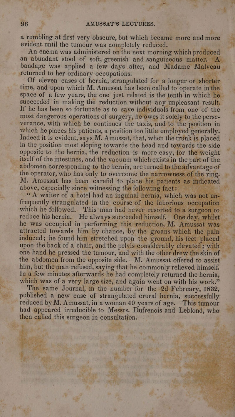 a 96 ' AMUSSAT’S LECTURES. a rumbling at first very obscure, but which became moré andmore … evident until the tumour was completely reduced. re a An enema was administered on the next morning which produced an abundant stool of soft, greenish and sanguineous matter. A. bandage was applied a few days after, and Madame Malveau _ returned to her ordinary occupations. TR Of eleven cases of hernia, strangulated for a longer or shorter time, and upon which M. Amussat has been called to operate in the space of a few years, the one just related is the tenth in which he > succeeded in making the reduction without any unpleasant result. If he has been so fortunate as to save individuals from one of the most dangerous operations of surgery, he owes it solely to the perse- verance, with which he continues the taxis, and to the position in _ which he places his patients, a position too little employed generally. Indeed it is evident, says M. Amussat, that, when the trunk is placed in the position most sloping towards the head and towards the side opposite to the hernia, the reduction is more easy, for the weight itself of the intestines, and the vacuum which exists in the part of the abdomen corresponding to the hernia, are turned to the advantage of the operator, who has only to overcome the narrowness of the ring. : M. Amussat has been careful to place his: atients as indicated 1 above, especially since witnessing the followin okie SN 0e EM ‘A waiter of a hotel had an inguinal hernia, which was no frequently strangulated in the course of the laborious occupation which he followed. This man had arts LE + surgeon to », S es un- À Lis 47 *4 reduce his hernia. He always succeeded himself. One day, whi ee he was occupied in performing this reduction, M. Amussat was +4 attracted towards him by chance, by the groans which the pain | induced; he found him stretched upon the ground, his feet | laced he | upon the back of a chair, and the pelvis considerably elevated ; with | p one hand he pressed the tumour, and with the other drew the skin of the abdomen from the opposite side.. M. Amussat offered to assist him, but the man refused, saying that he commonly relieved himself. In a few minutes afterwards he had completely returned the hernia, which was of a very large size, and again went on with his work.” The same Journal, in the number for the 2d February, 1832, published a new case of strangulated crural hernia, successfully reduced by M. Amussat, in a woman 40 years of age. Thistumour had appeared irreducible to Messrs. Dufrenois and Leblond, who then called this surgeon in consultation. as iy 2 £ La ARE : 4 4 NE, Ex wt’ x a Me RAT ¥ . Là 4 % 400) A. Liv ;
