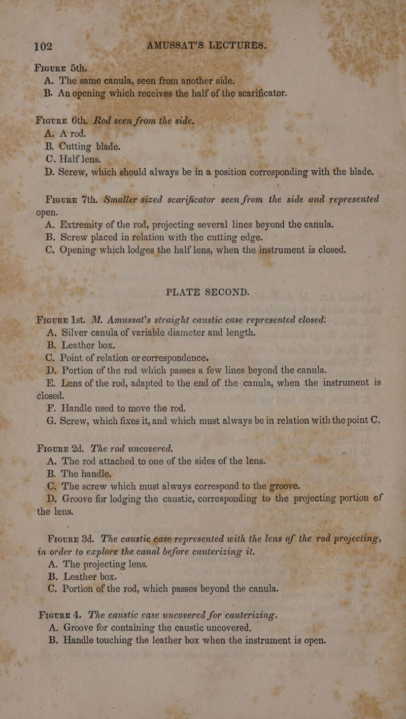 102 Pe à Fieure oth. À PAU à a, ' a sy Wiest | PERTE | VE vu fl, | eee 6th. Rod : pom the AE EN ER Ne Lo jé : REA r A. A rod. ne: = * | Er % à ; ae y n x ue B. Cutting blade. oi on ‘* b sys 7 N° OC. Half lens. 9: | vt 4 D. Screw, which s should always be ina posttiaa corresponding with the blade. _ ÿ Ficure “th, ” sized scarificator seen from the side and represented | open. A. Extremity of the rod, projecting several lines beyond the canula. | B. Screw placed in relation with the cutting edge. ee C. Opening which lodges the half lens, when the — is closed. Re ee > PLATE SECOND. Ficure Ist. M. Amussat’s straight caustic case represented closed: A, Silver canula of variable diameter and length. B. Leather box. ae C. Point of relation or correspondence. ~ ay * D. Portion of the rod which passes a few lines beyond the canula. ~_E. Lens of the rod, HN to the end of the canula, when the instrument is closed. | F. Handle used to move the rod. : it G. Screw, which fixes it, and which must always be in relation with the point C. Figure 2d. The rod uncovered. he Sh. eae OB ae A. The rod attached to one of the sides of the lens = B. The handle. Hs -C: The screw which must always di to the ¢ SA AR D. Groove for lodging the AI cone a e projecting partion of the lens. ea qu et \ # ee 3d. The caustic case represented with the lens of the “s in order to explore the canal before cauterizing it. — PE | A. The projecting lens. B. Leather box. iv C. Portion of the rod, which passes beyond the canula. Le ; Ce Ficurr 4. The caustic case uncovered for cauterizing. A. Groove for containing the caustic uncovered. he a. > 7 B. Handle touching the leather box when the instrument is open. : West,