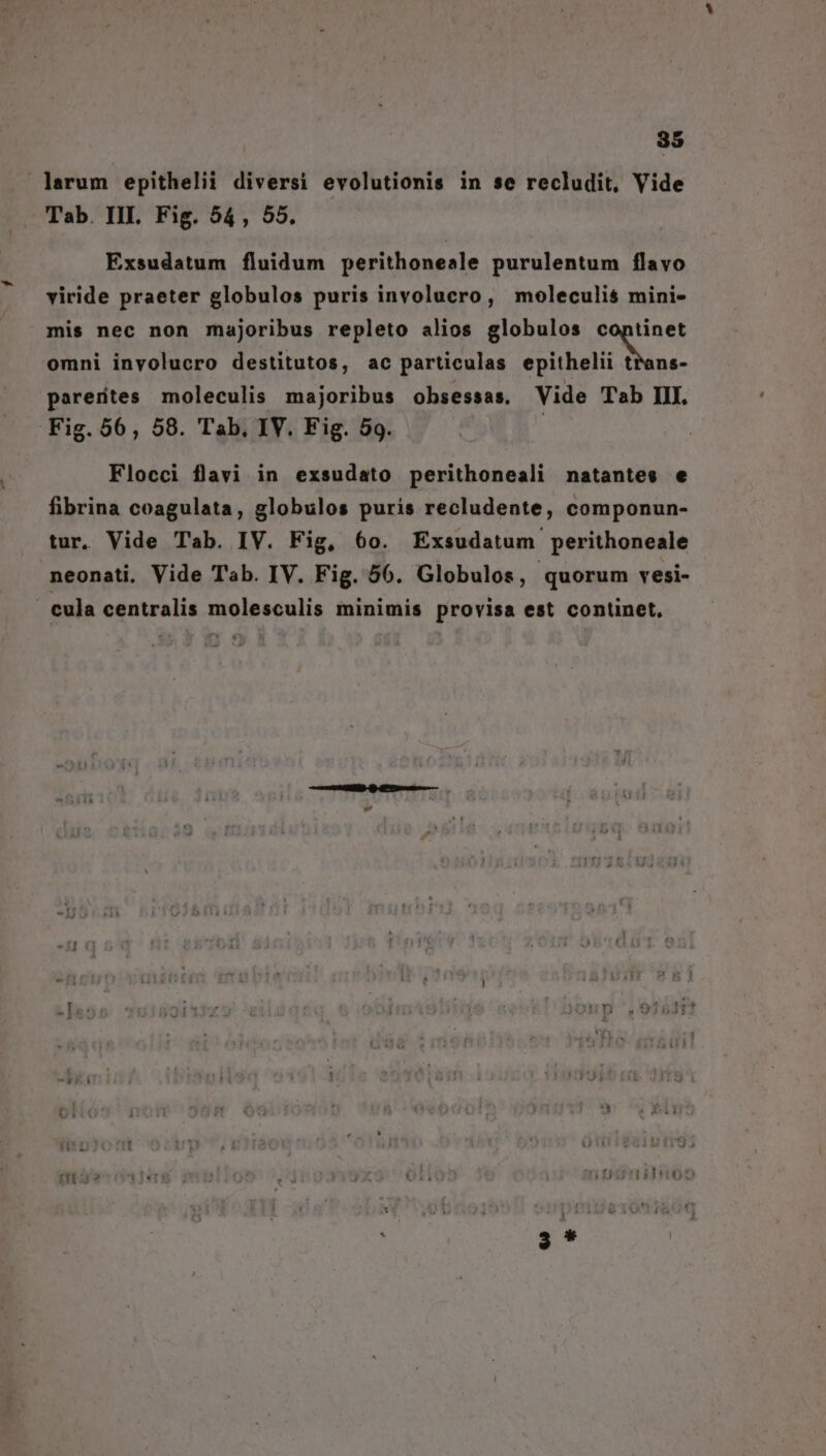 Jarum epithelii diversi evolutionis in se recludit, Vide Tab. III. Fig. 54, 55. Exsudatum fluidum perithoneale purulentum flavo viride praeter globulos puris involucro, moleculis mini- mis nec non majoribus repleto alios globulos coptinet omni involucro destitutos, ac particulas d oiholti Mns parertes moleculis majoribus obsessas. Vide Tab III. Fig. 56, 58. Tab, IV. Fig. 59. Flocci flavi in exsudato perithoneali natantes e fibrina coagulata, globulos puris recludente, componun- tur. Vide Tab. IV. Fig, 60. Exsudatum perithoneale neonati. Vide Tab. IV. Fig. 56. Globulos, quorum vesi- | cula centralis molesculis minimis provisa est continet, ;*