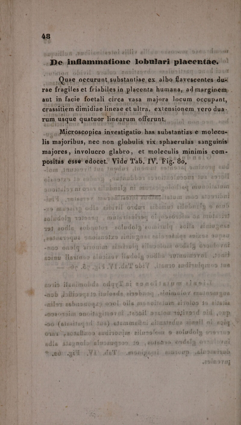  [| ; ATP | T ' $31 :f T3 719111 e 414 hy ET De inflammatione lobulari placentàe. i ^A Quae. occurunt, pup ex aea E m rae » fragileé et friabiles in placenta humana, ad marginem, . aut in facie foetali circa vasa majora locum occupant, crassitiem dimidiae lineae et ultra, extensionem . yero dua- rum usque quatuor inearum offerunt. ..Microscopica investigatio: has. substantias e molecu« lis majoribus, nec non globulis. vix. sphaerulas sanguinis! majores, involucro glabro, et moleculis minimis com- Loren ésse 'wdáébr. su Tab. IV. Fig. 80, - ? Hi hu  » i v. , i c t. , 2 191 2 (31  FERE! 4 1:4 € ; T L] ; M  E - T9 2? ! i4 1 ^ | T ' . B5OIrng :1513 tá C , 11150140 [.! .1  fs rii HT ] i ! : é b 4 ! I 1351 eübfbibioY fti ! naa .  | 4 ti 5 ' 4 )ir&amp; d ' I! [2 o , ie  $* *of* L] w PORT. 2 1 , o4 19/179 : [| * - í 561 r i » * M! h T  n n [o M Li À ! 11 it. EI »591t( b 80140 P I L ! r1 ' * B i L1  3  ! TE | e !1 , 1 i — L bibi » ,
