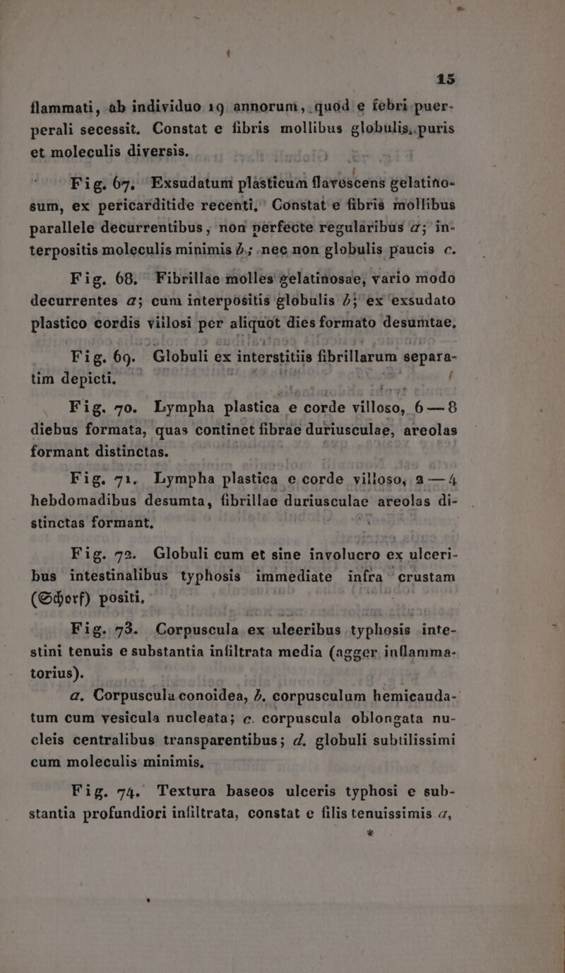flammati, ab individuo 19. annoruni, .quod e febri. puer- perali secessit, Constat e fibris mollibus globulis,. puris et moleculis diversis. Fig.67, Exsudatum plàásticum flaróscens gelatino- sum, ex pericarditide recenti, ' Constat e fibriá mollibus parallele decurrentibus , non perfecte regularibus 7; in- terpositis moleculis minimis 2.; nec non globulis paucis c. Fig. 68. Fibrillae molles gelatinosae, vario modo decurrentes 2; cum interpositis globulis 2; ex exsudato plastico cordis viilosi per aliquot dies formato desumtae, Fig. 69. : Globuli ex interstitiis fibrillarum separa- tim depicti. | EMO OE RENDER í Fig. 7o. Lympha plastica e corde villoso, 6—8 diebus formata, quas continet fibrae duriusculae, areolas formant distinctas. | Fig. 71. Lympha plastica e corde villoso, 2 — 4 hebdomadibus desumta, fibrillae duriusculae areolas di- stinctas formant, $i Fig. 72. Globuli cum et sine involucro ex ulceri- bus intestinalibus typhosis immediate infra crustam (Gdorf) positi, Fig. 73. Corpuscula ex uleeribus typhosis inte- stini tenuis e substantia infiltrata media (agger inflamma- torius). | 2. Corpuscula conoidea, /. corpusculum hemicauda-: tum cum vesicula nucleata; c. corpuscula oblongata nu- cleis centralibus transparentibus; 4. globuli subiilissimi cum moleculis minimis, Fig. 74. Textura baseos ulceris typhosi e sub- stantia profundiori infiltrata, constat e filis tenuissimis 2, *