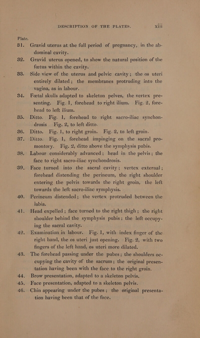 ol. 32. 33. 34. 35. 36. 7. 38. 39,. 40. Al. 42. 45. 44, 45. 46. DESCRIPTION OF THE PLATES. Xl Gravid uterus at the full period of pregnancy, in the ab- dominal cavity. Gravid uterus opened, to show the natural position of the foetus within the cavity. Side view of the uterus and pelvic cavity; the os uteri entirely dilated; the membranes protruding into the vagina, as in labour. Foetal skulls adapted to skeleton pelves, the vertex pre- senting. Fig. 1, forehead to right ilium. Fig. 2, fore- head to left ilium. Ditto. Fig. 1, forehead to right sacro-iliac synchon- drosis_ Fig. 2, to left ditto. Ditto. Fig. 1, to right groin. Fig. 2, to left groin. Ditto. Fig. 1, forehead impinging on the sacral pro- montory. Fig. 2, ditto above the symphysis pubis. Labour considerably advanced; head in the pelvis; the face to right sacro-iliac synchondrosis. Face turned into the sacral cavity; vertex external ; forehead distending the perineum, the right shoulder entering the pelvis towards the right groin, the left towards the left sacro-iliac symphysis. Perineum distended; the vertex protruded between the labia. Head expelled ; face turned to the right thigh; the right shoulder behind the symphysis pubis; the left occupy- ing the sacral cavity. Examination in labour. Fig. 1, with index finger of the. right hand, the os uteri just opening. Fig. 2, with two fingers of the left hand, os uteri more dilated. The forehead passing under the pubes; the shoulders oc- cupying the cavity of the sacrum; the original presen- tation having been with the face to the right groin. Brow presentation, adapted to a skeleton pelvis. Face presentation, adapted to a skeleton pelvis. Chin appearing under the pubes; the original presenta- tion having been that of the face.