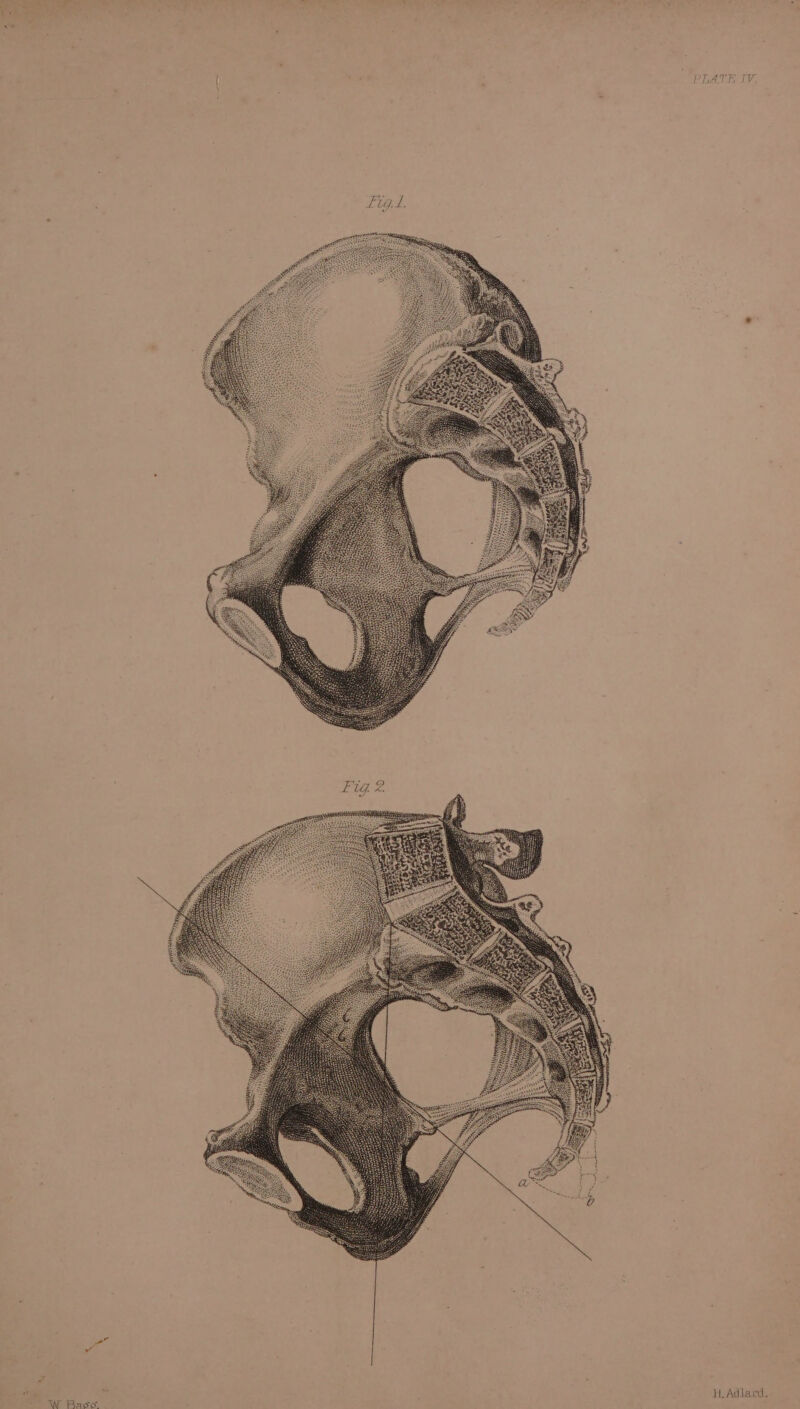 IV. PLATE £ 1G. ye }L Adlard. a) W Race”