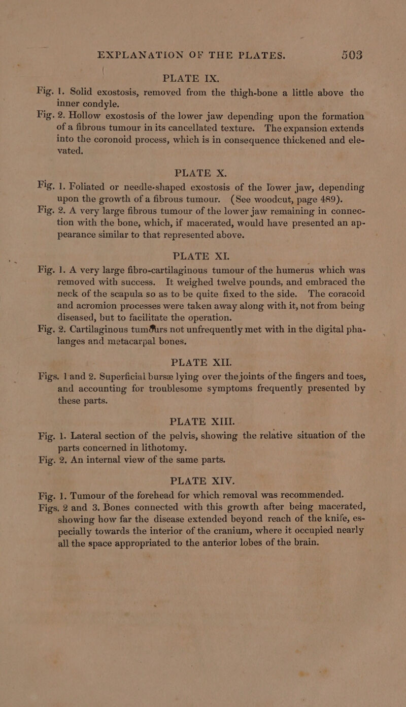 { PLATE IX. Fig. I. Solid exostosis, removed from the thigh-bone a little above the inner condyle. Fig. 2. Hollow exostosis of the lower jaw depending upon the formation of a fibrous tumour in its cancellated texture. The expansion extends Into the coronoid process, which is in consequence thickened and ele- vated, PLATE X. Fig, 1, Foliated or needle-shaped exostosis of the lower jaw, depending upon the growth of a fibrous tumour. (See woodcut, page 489). Fig. 2. A very large fibrous tumour of the lower jaw remaining in connec- tion with the bone, which, if macerated, would have presented an ap- pearance similar to that represented above. PLATE XI. Fig. 1. A very large fibro-cartilaginous tumour of the humerus which was removed with success. It weighed twelve pounds, and embraced the neck of the scapula so as to be quite fixed to the side. The coracoid and acromion processes were taken away along with it, not from being diseased, but to facilitate the operation. Fig. 2. Cartilaginous tum@urs not unfrequently met with in the a ibe pha- langes and metacarpal bones. PLATE XIL. Figs. land 2. Superficial burse lying over the joints of the fingers and toes, and accounting for troublesome symptoms frequently presented by these parts. PLATE XIII. Fig. 1. Lateral section of the pelvis, showing the relative situation of the parts concerned in lithotomy. Fig. 2. An internal view of the same parts. PLATE XIV. Fig. 1. Tumour of the forehead for which removal was recommended. Figs. 2 and 3. Bones connected with this growth after being macerated, showing how far the disease extended beyond reach of the knife, es- pecially towards the interior of the cranium, where it occupied nearly all the space appropriated to the anterior lobes of the brain.