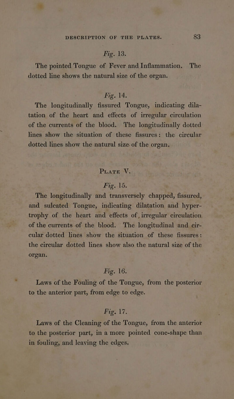 Fig. 13. The pointed Tongue of Fever and Inflammation. The dotted line shows the natural size of the organ. Fig. 14. The longitudinally fissured Tongue, indicating dila- tation of the heart and effects of irregular circulation of the currents of the blood. The longitudinally dotted lines show the situation of these fissures: the circular dotted lines show the natural size. of the organ. PLATE V. Fig. 15. The longitudinally and transversely chapped, fissured, and sulcated Tongue, indicating dilatation and hyper- trophy of the heart and effects of, irregular circulation of the currents of the blood. The longitudinal and cir- cular dotted lines show the situation of these fissures: the circular dotted lines show also the natural size of the organ. Ing. 16. Laws of the Fouling of the Tongue, from the posterior to the anterior part, from edge to edge. Fig. 17. Laws of the Cleaning of the Tongue, from the anterior to the posterior part, in a more pointed cone-shape than in fouling, and leaving the edges.