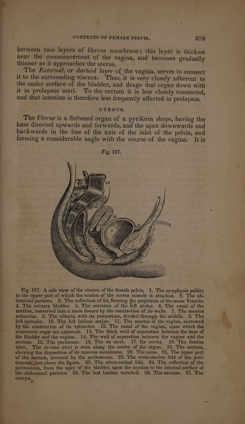 2 a eee EY sean CONTENTS OF FEMALE PELVIS. 573 between two layers of fibrous membrane; this layer is thickest near the commencement of the vagina, and becomes gradually thinner as it approaches the uterus. The External, or dartoid layer of the vagina, serves to connect it to the surrounding viscera. ‘Thus, it is very closely adherent to the under surface of the bladder, and drags that organ down with it in prolapsus uteri. To the rectum it is less closely connected, and that intestine.is therefore less frequently affected in prolapsus. UTERUS. The Uterus is a flattened organ of a pyriform shape, having the base directed upwards and forwards, and the apex downwards and backwards in the line of the axis of the inlet of the pelvis, and forming a considerable angle with the course of the vagina. It is Vij V 7, / YAW Nh - w. » ) » = Fig. 197. A side view of the viscera of the female pelvis. 1. The symphysis pubis; to the upper part of which the tendon of the rectus muscle is attached. 2. The ab- dominal parietes. 3. The collection of fat, forming Hie projection of the mons Veneris. 4, The urinary bladder. 5, The entrance of the left ureter. 6. The. canal of the urethra, converted into a mere fissure by the contraction of its walls. 7. The meatus urinarius. 8, The clitoris, with its praeputium, divided through the middle. 9. The left nympha. 10. The left labium majus. 11. The meatus of the vagina, narrowed the bladder and the vagina. 14, The wall of separation between the vagina and the rectum, 15. The perineum. 16. The os uteri. 17. Its cervix. 18. The fundus uteri. The cavitas. uteri is seen along the centre of the organ. 19. The rectum, of the rectum, invested by the peritoneum, 22, The recto-uterine fold of the peri- peritoneum, from the apex of the bladder, upon the trachus to the internal surface of the abdominal parietes. 25. The last lumbar vertebrd. 26. The sacrum. 27. The coccyx. Ty)