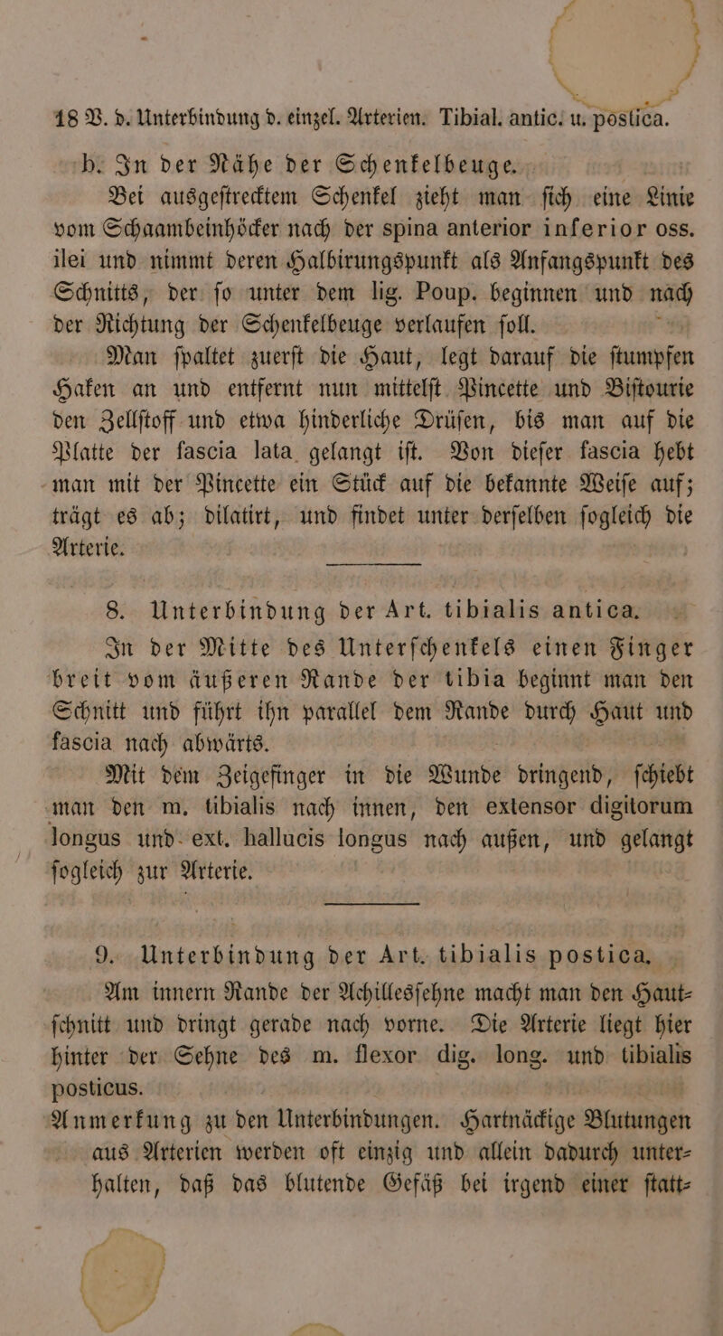 b. In der Nähe der Schenkelbeuge. Bei ausgeſtrecktem Schenkel zieht man ſich eine Linie vom Schaambeinhöcker nach der spina anterior inferior oss. ilei und nimmt deren Halbirungspunkt als Anfangspunkt des Schnitts, der ſo unter dem lig. Poup. beginnen und Fo der Richtung der Schenfelbeuge verlaufen ſoll. : Man ſpaltet zuerft die Haut, legt darauf die eue Haken an und entfernt nun mittelſt Pincette und Biſtourie den Zellſtoff und etwa hinderliche Drüſen, bis man auf die Platte der fascia lata gelangt if. Von dieſer fascia hebt man mit der Pincette ein Stück auf die bekannte Weiſe auf; trägt es ab; dilatirt, und findet unter derſelben ſogleich die Arterie. 1184 8. Unterbindung der Art. tibialis antica, In der Mitte des Unterſchenkels einen Finger breit vom äußeren Rande der tibia beginnt man den Schnitt und führt ihn parallel dem Rande durch Haut und fascia nach abwärts. Mit dem Zeigefinger in die Wunde dringend, ſchiebt man den m. libialis nach innen, den extensor digitorum longus und ext. hallucis longus nach außen, und gelangt ſogleich zur Arterie. 9. Unterbindung der Art. tibialis postica. Am innern Rande der Achillesſehne macht man den Haut⸗ ſchnitt und dringt gerade nach vorne. Die Arterie liegt hier hinter der Sehne des m. flexor dig. long. und tibialis posticus. | Anmerfung zu Den Unterbindungen. Sartnädige Blutungen aus Arterien werden oft einzig und allein dadurch unter⸗ halten, daß das blutende Gefäß bei irgend einer ſtatt—