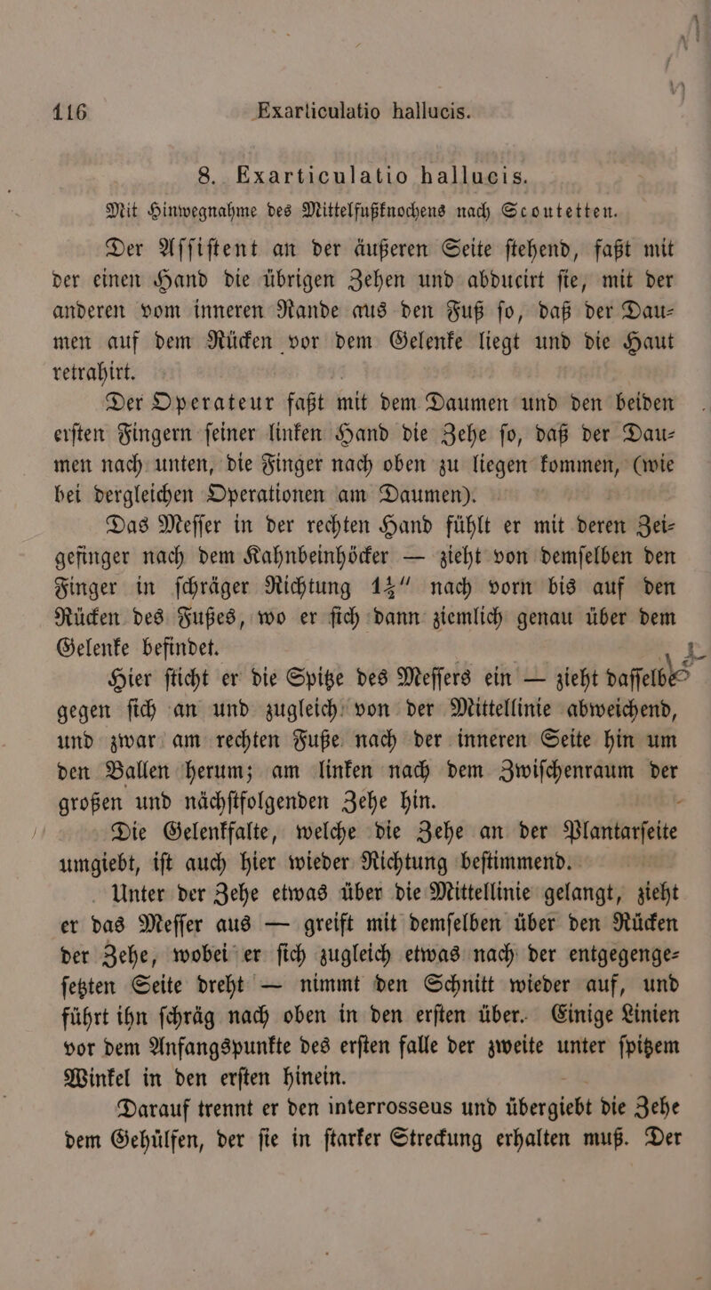 8. Exarticulatio hallueis. Mit Hinwegnahme des Mittelfußknochens nach Scoutetten. Der Aſſiſtent an der äußeren Seite ſtehend, faßt mit der einen Hand die übrigen Zehen und abdueirt ſie, mit der anderen vom inneren Rande aus den Fuß fo, daß der Dau⸗ men auf dem Rücken vor dem Gelenke liegt und die Haut retrahirt. Der Operateur faßt mit dem Daumen und den beiden erſten Fingern ſeiner linken Hand die Zehe ſo, daß der Dau— men nach unten, die Finger nach oben zu liegen kommen, (wie bei dergleichen Operationen am Daumen). Das Meſſer in der rechten Hand fühlt er mit bert Zei⸗ gefinger nach dem Kahnbeinhöcker — zieht von demſelben den Finger in ſchräger Richtung 13“ nach vorn bis auf den Rücken des Fußes, wo er ſich dann ziemlich genau über dem Gelenke befindet. | R Hier ſticht er die Spitze des Meſſers ein — zieht daſſelbes gegen ſich an und zugleich von der Mittellinie abweichend, und zwar am rechten Fuße nach der inneren Seite hin um den Ballen herum; am linken nach dem Zwiſchenraum der großen und nächſtfolgenden Zehe hin. Die Gelenkfalte, welche die Zehe an der Plantarſelte umgiebt, iſt auch hier wieder Richtung beſtimmend. Unter der Zehe etwas über die Mittellinie gelangt, zieht er das Meſſer aus — greift mit demſelben über den Rücken der Zehe, wobei er ſich zugleich etwas nach der entgegenge— ſetzten Seite dreht — nimmt den Schnitt wieder auf, und führt ihn ſchräg nach oben in den erſten über. Einige Linien vor dem Anfangspunkte des erſten falle der zweite unter ſpitzem Winkel in den erſten hinein. Darauf trennt er den interrosseus und übergiebt die Zehe dem Gehuͤlfen, der fie in ſtarker Streckung erhalten muß. Der