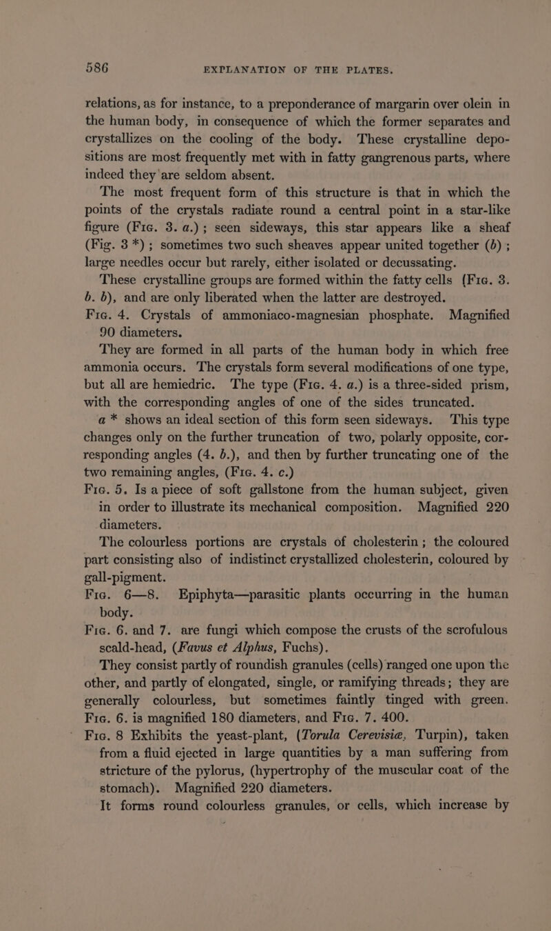 relations, as for instance, to a preponderance of margarin over olein in the human body, in consequence of which the former separates and crystallizes on the cooling of the body. These crystalline depo- sitions are most frequently met with in fatty gangrenous parts, where indeed they'are seldom absent. The most frequent form of this structure is that in which the points of the crystals radiate round a central point in a star-like figure (Fic. 3. a.); seen sideways, this star appears like a sheaf (Fig. 3 *) ; sometimes two such sheaves appear united together (0) ; large needles occur but rarely, either isolated or decussating. These crystalline groups are formed within the fatty cells (Fie. 3. b. b), and are only liberated when the latter are destroyed. Fie. 4. Crystals of ammoniaco-magnesian phosphate. Magnified 90 diameters. They are formed in all parts of the human body in which free ammonia occurs. The crystals form several modifications of one type, but all are hemiedric. The type (Fic. 4. a.) is a three-sided prism, with the corresponding angles of one of the sides truncated. a * shows an ideal section of this form seen sideways. This type changes only on the further truncation of two, polarly opposite, cor- responding angles (4. d.), and then by further truncating one of the two remaining angles, (Fie. 4. c.) Fic. 5. Is a piece of soft gallstone from the human subject, given in order to illustrate its mechanical composition. Magnified 220 diameters. The colourless portions are crystals of cholesterin ; the coloured part consisting also of indistinct crystallized cholesterin, coloured by gall-pigment. Fie. 6—8. Epiphyta—parasitic plants occurring in the human body. Fie. 6. and 7. are fungi which compose the crusts of the scrofulous scald-head, (Favus et Alphus, Fuchs). They consist partly of roundish granules (cells) ranged one upon the other, and partly of elongated, single, or ramifying threads; they are generally colourless, but sometimes faintly tinged with green. Fie. 6. is magnified 180 diameters, and Fie. 7. 400. Fic. 8 Exhibits the yeast-plant, (Torula Cerevisie, Turpin), taken from a fluid ejected in large quantities by a man suffering from stricture of the pylorus, (hypertrophy of the muscular coat of the stomach). Magnified 220 diameters. It forms round colourless granules, or cells, which increase by