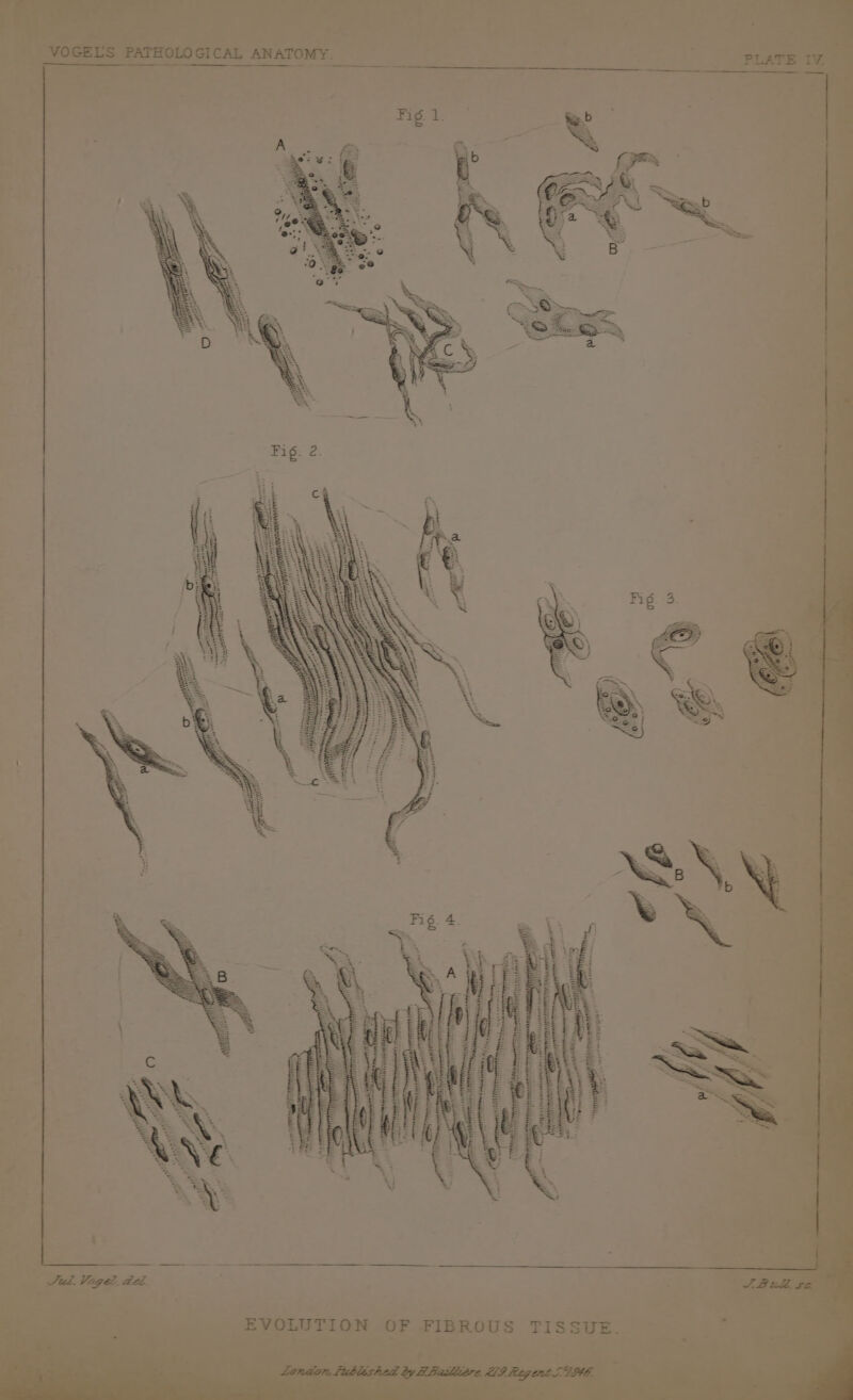 Fig. 2. (waa SINN EN Y N NN ERINNERT ah | ij gH AAA N ei NORRRTHTENERR ED, wee ; wii | ~ Jud. Vogel. de. AB ull, $a EVOLUTION OF FIBROUS TISSUE London, liublished by H-Baslissre. 219 Regent! TIE.